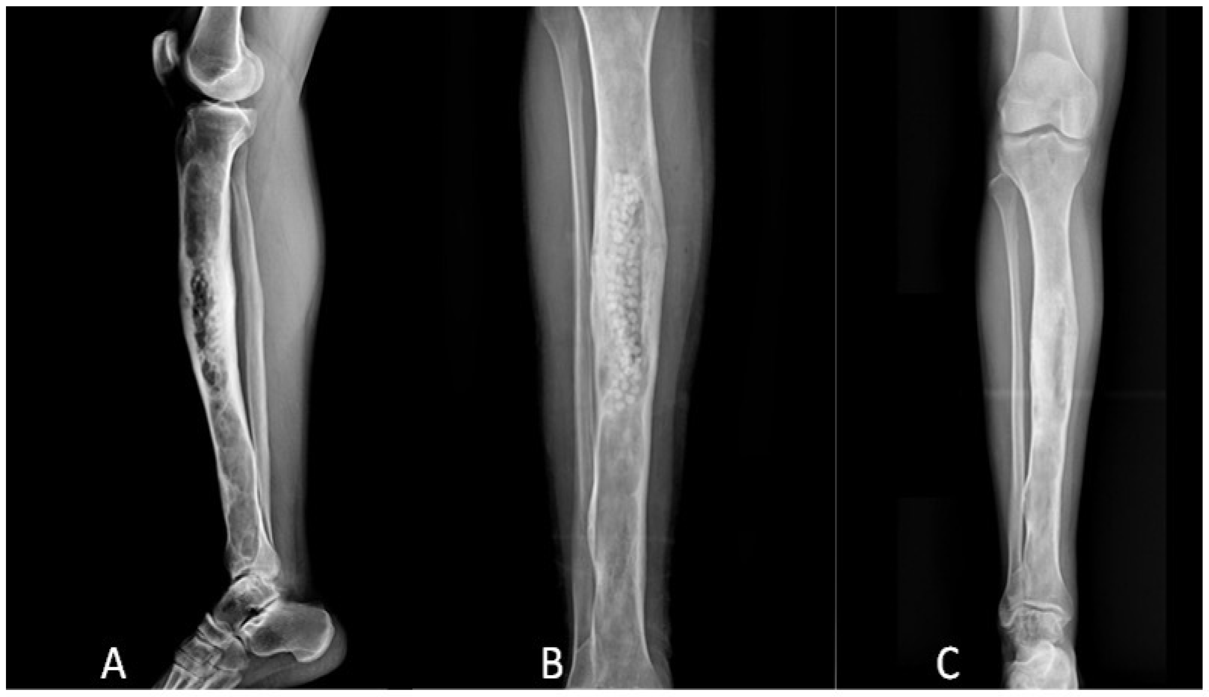 Microorganisms 11 01623 g002