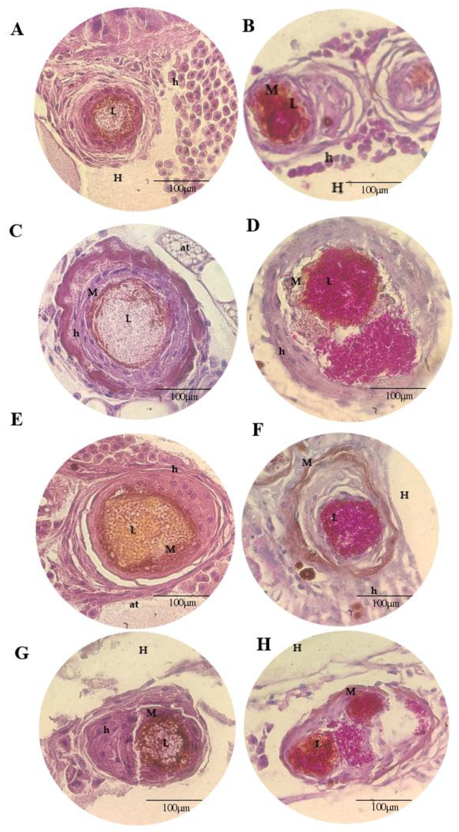 Microorganisms 11 01626 g008 Microorganisms 11 01626 g008