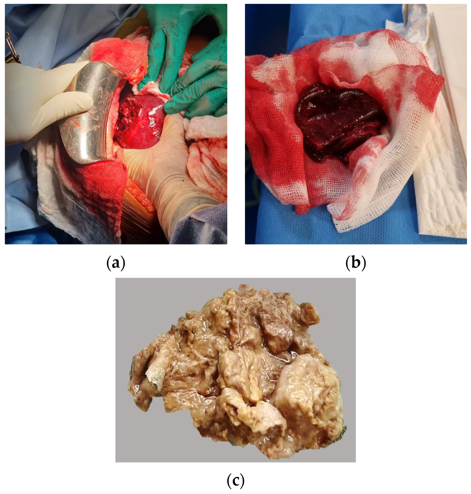 Microorganisms 11 02137 g002
