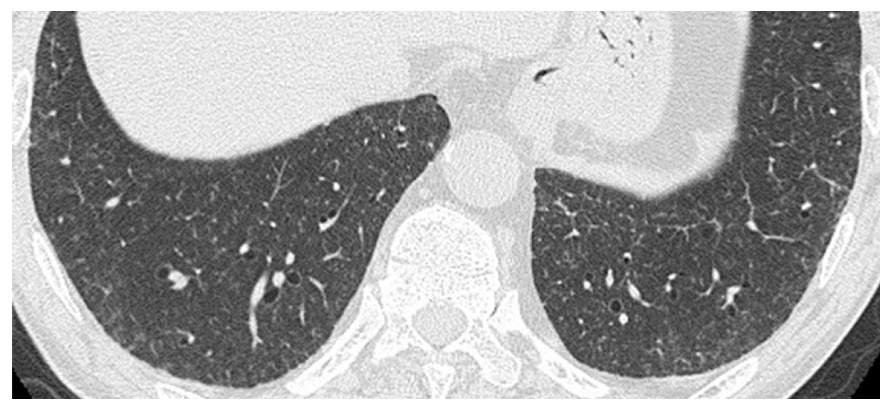 Microorganisms 11 02145 g001