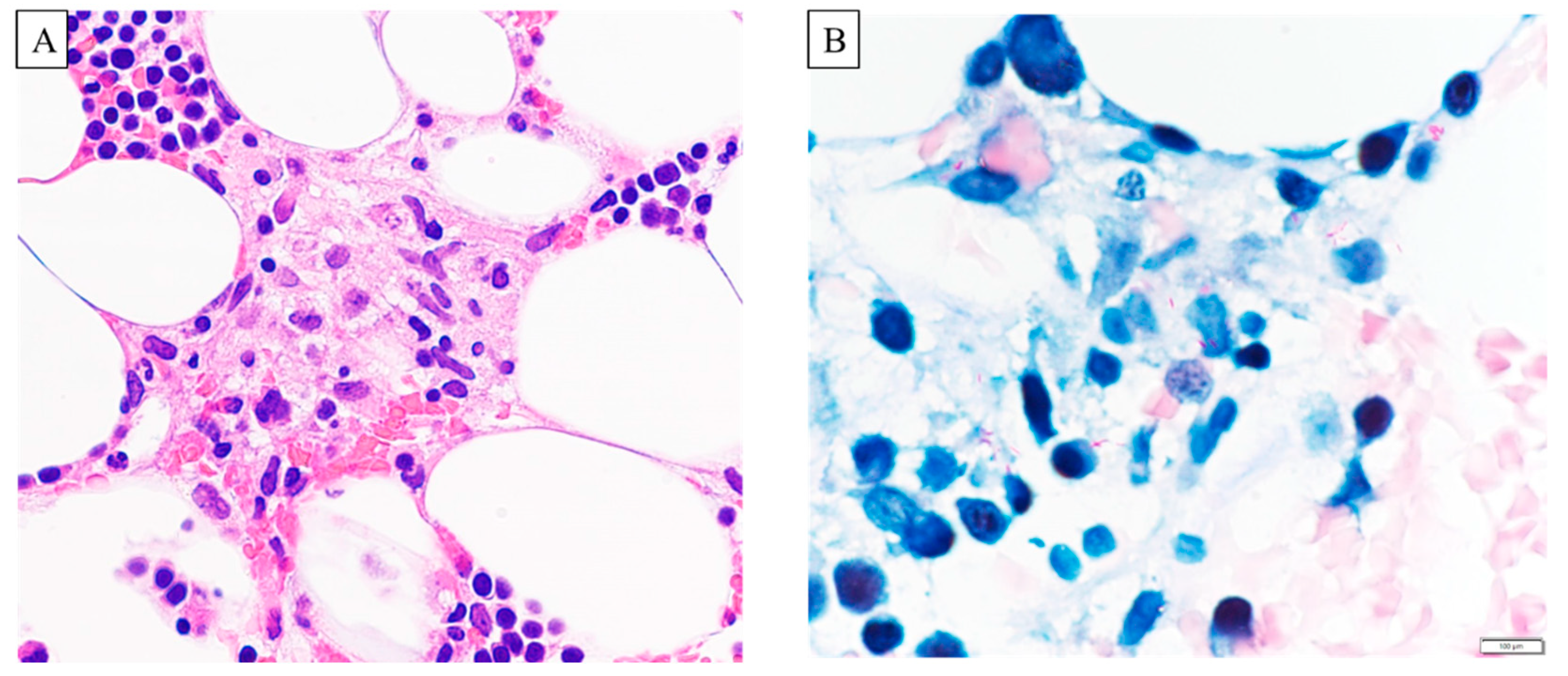 Microorganisms 11 02145 g002