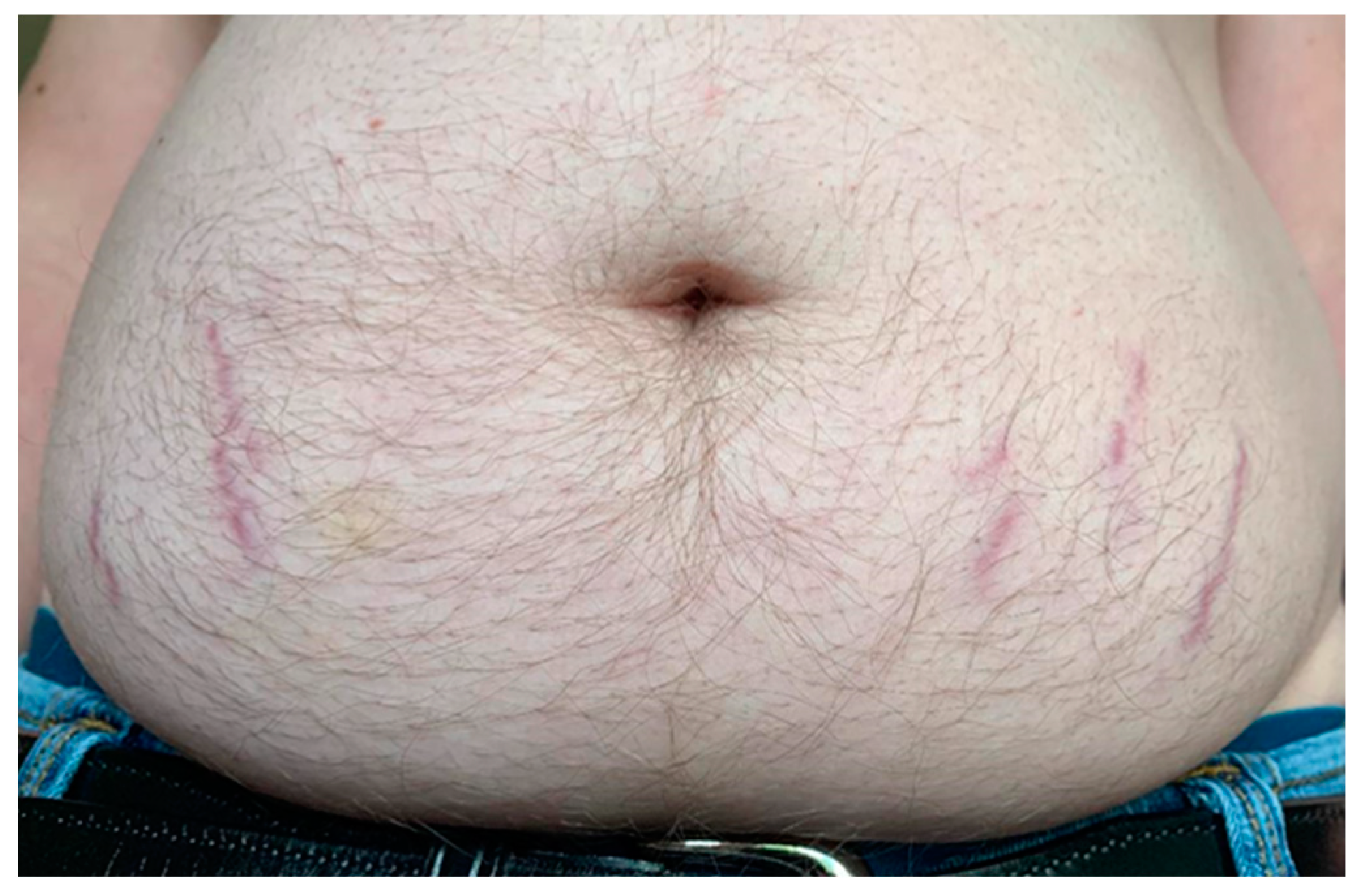 Microorganisms 11 02301 g003