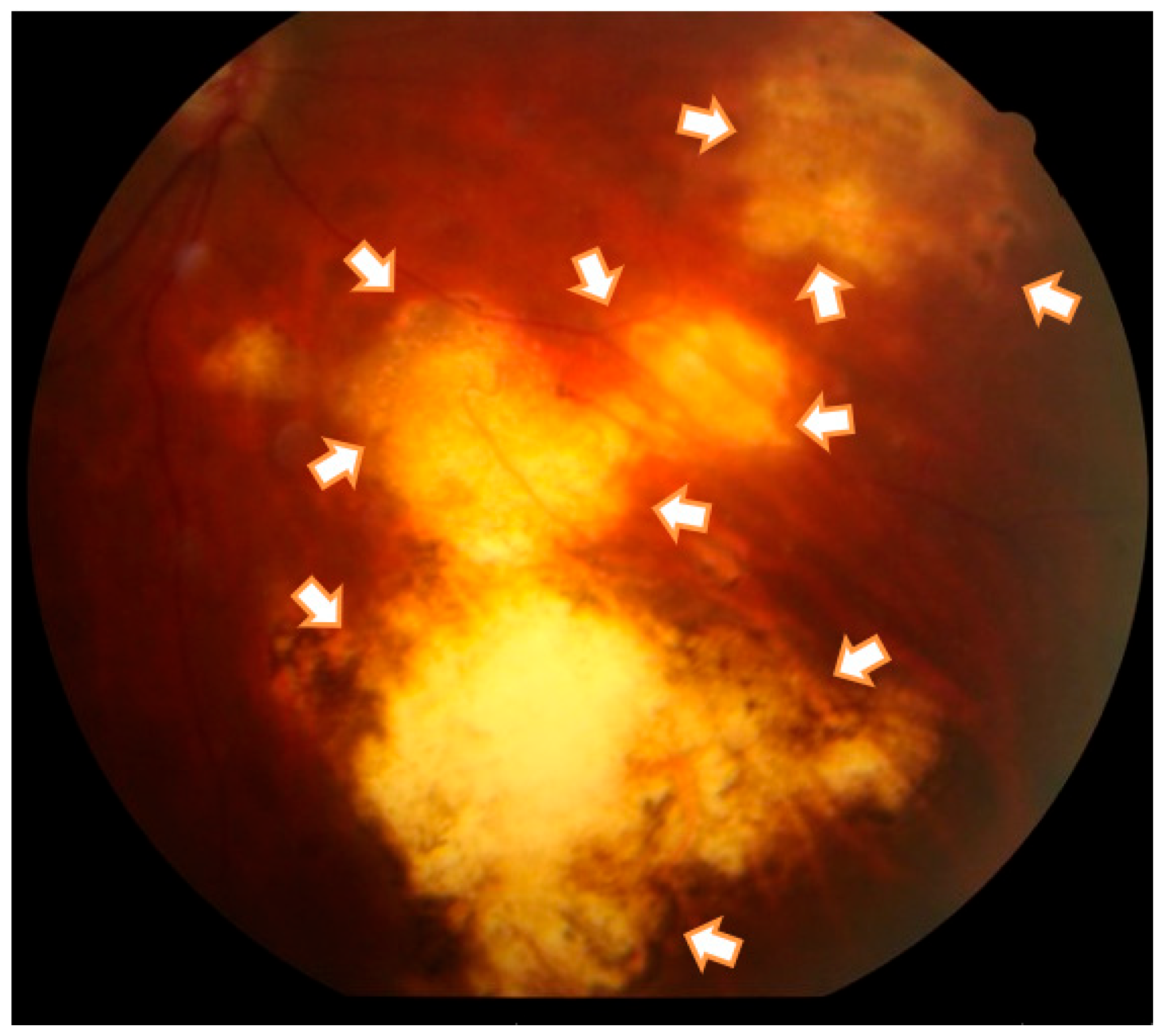 Microorganisms 11 02508 g001