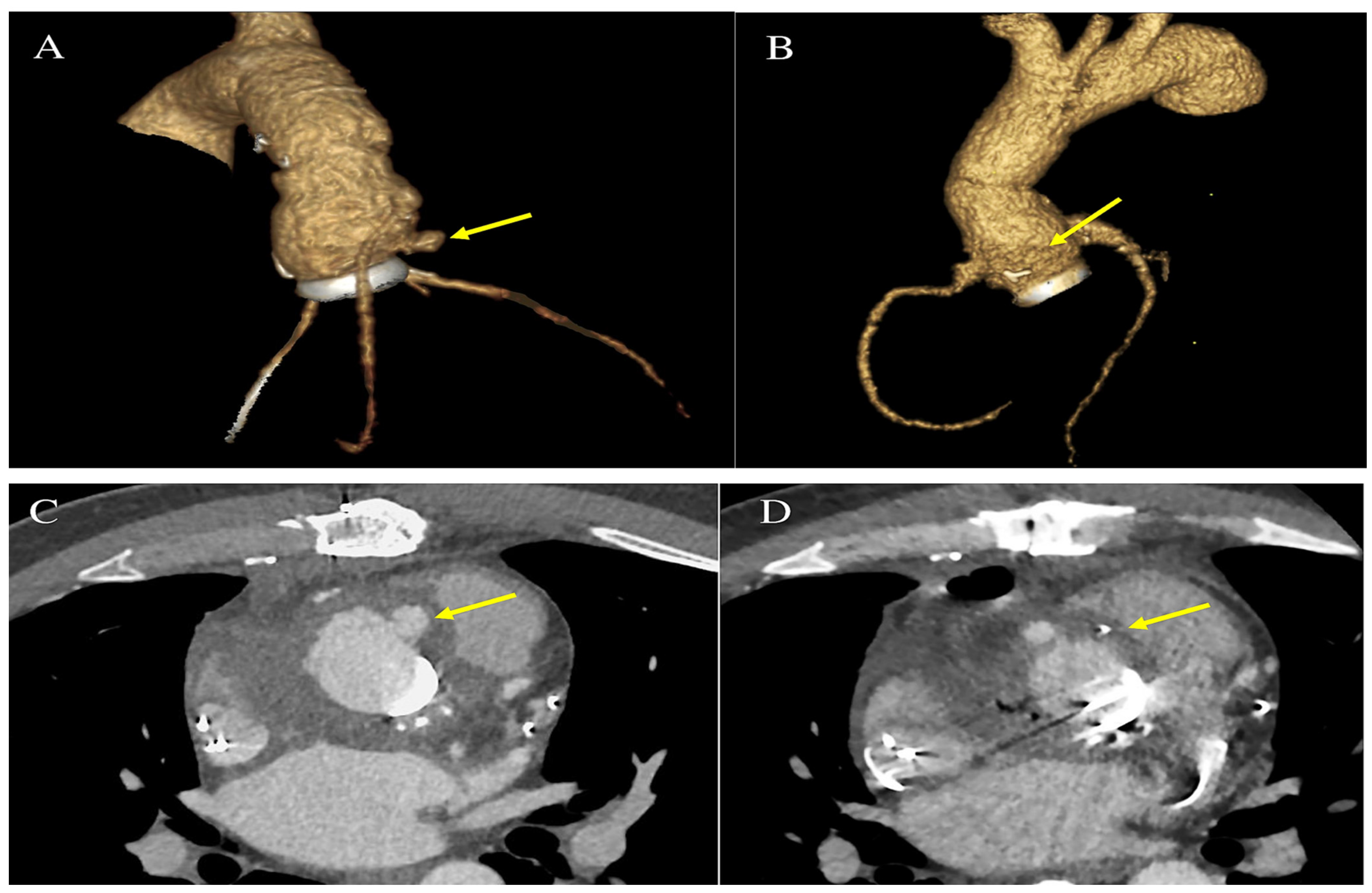 Microorganisms 11 02604 g005 Microorganisms 11 02604 g005