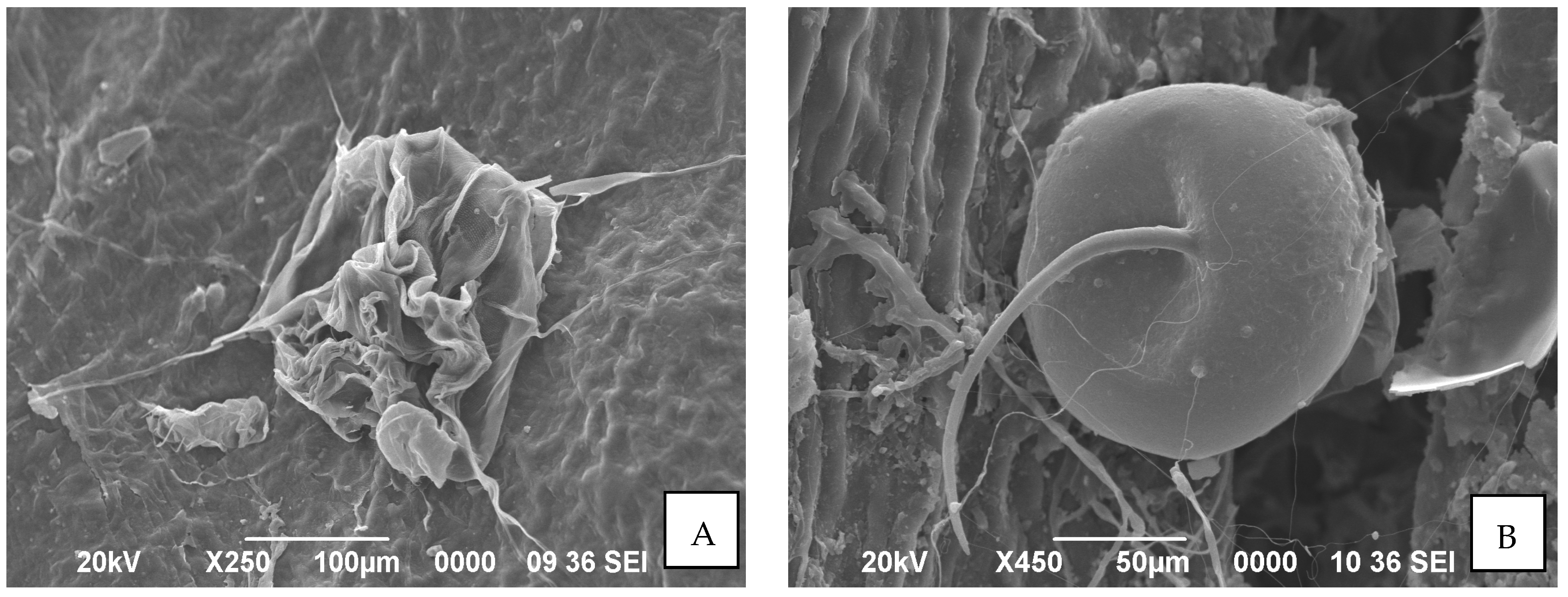 Microorganisms 11 02691 g004