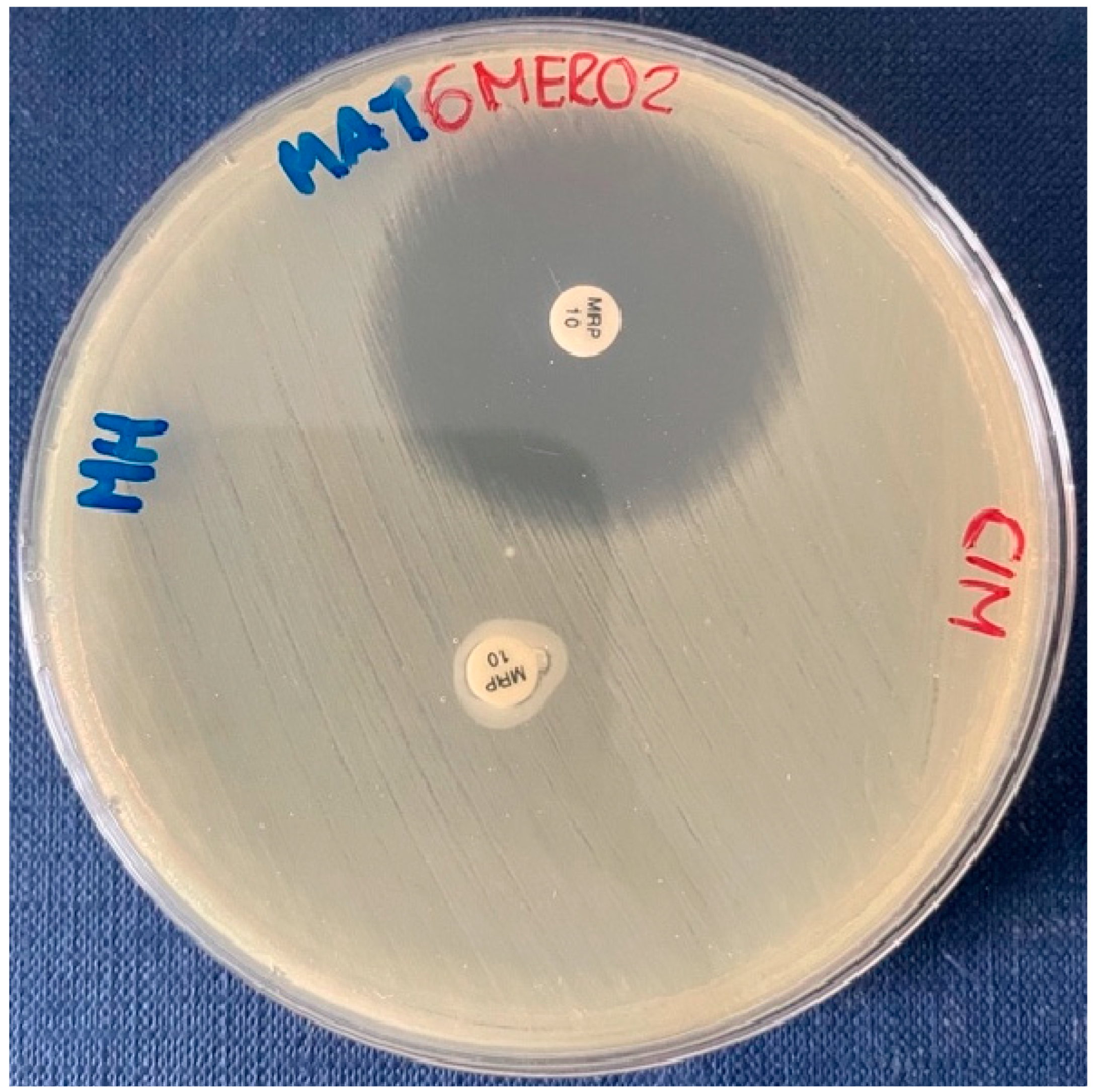 Microorganisms 11 02833 sch004