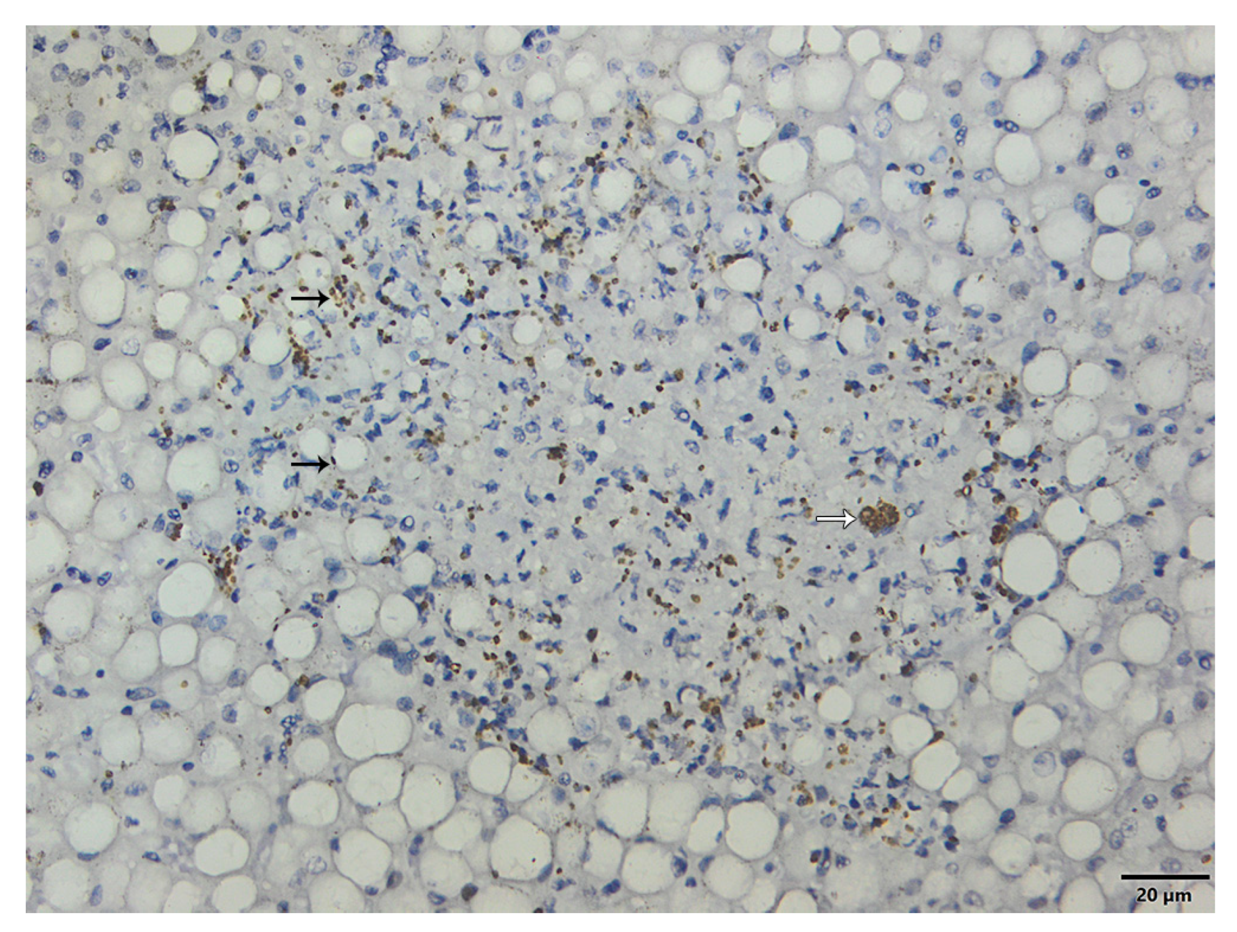 Microorganisms 11 02888 g004