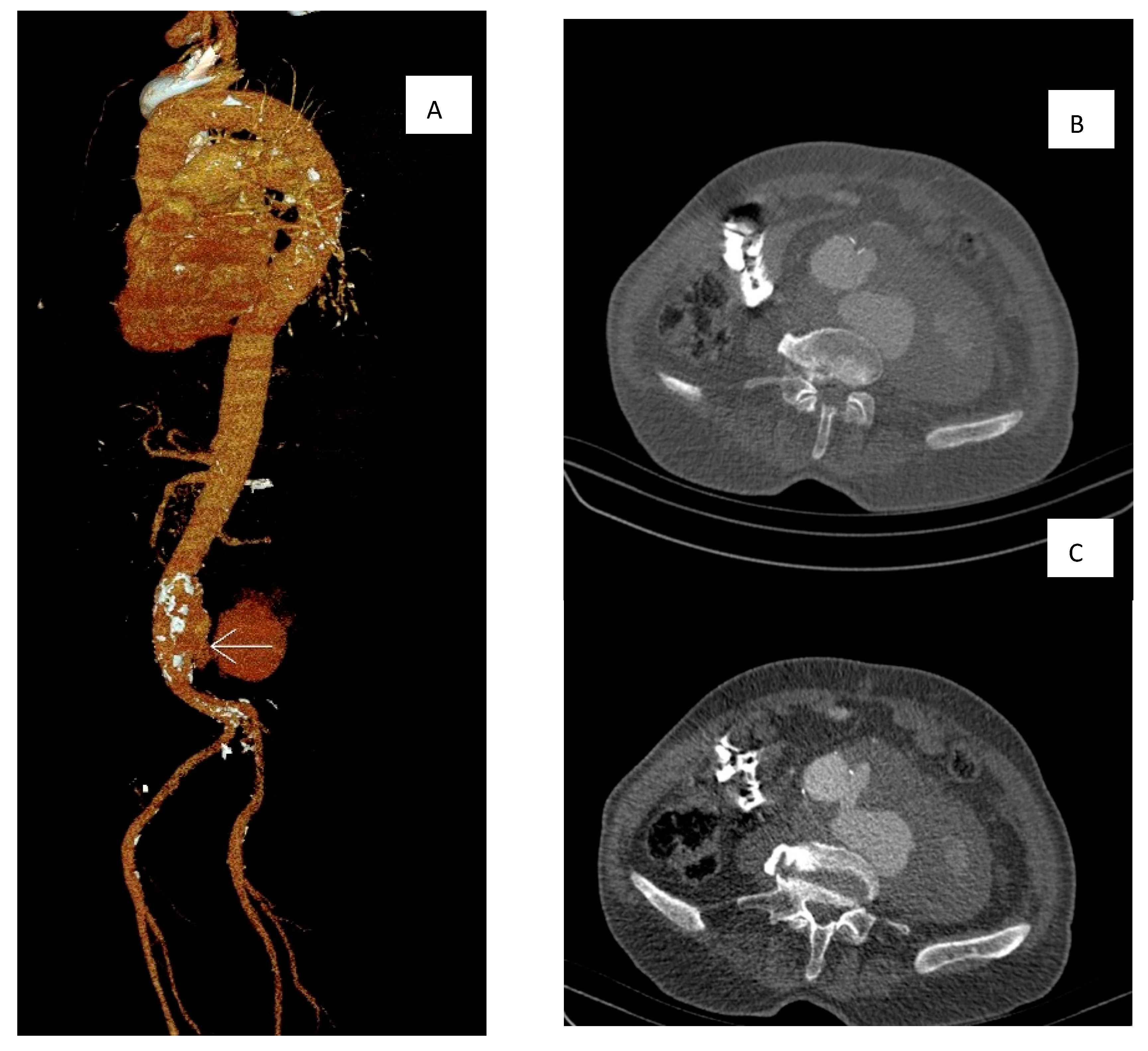 Microorganisms 11 02911 g001 Microorganisms 11 02911 g001