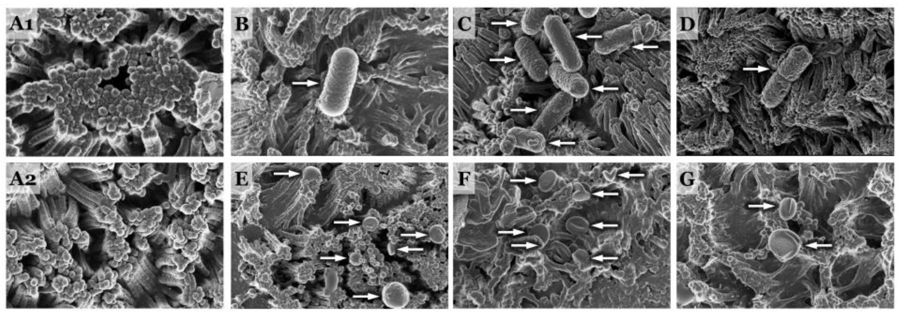 Microorganisms 11 02942 g005 Microorganisms 11 02942 g005