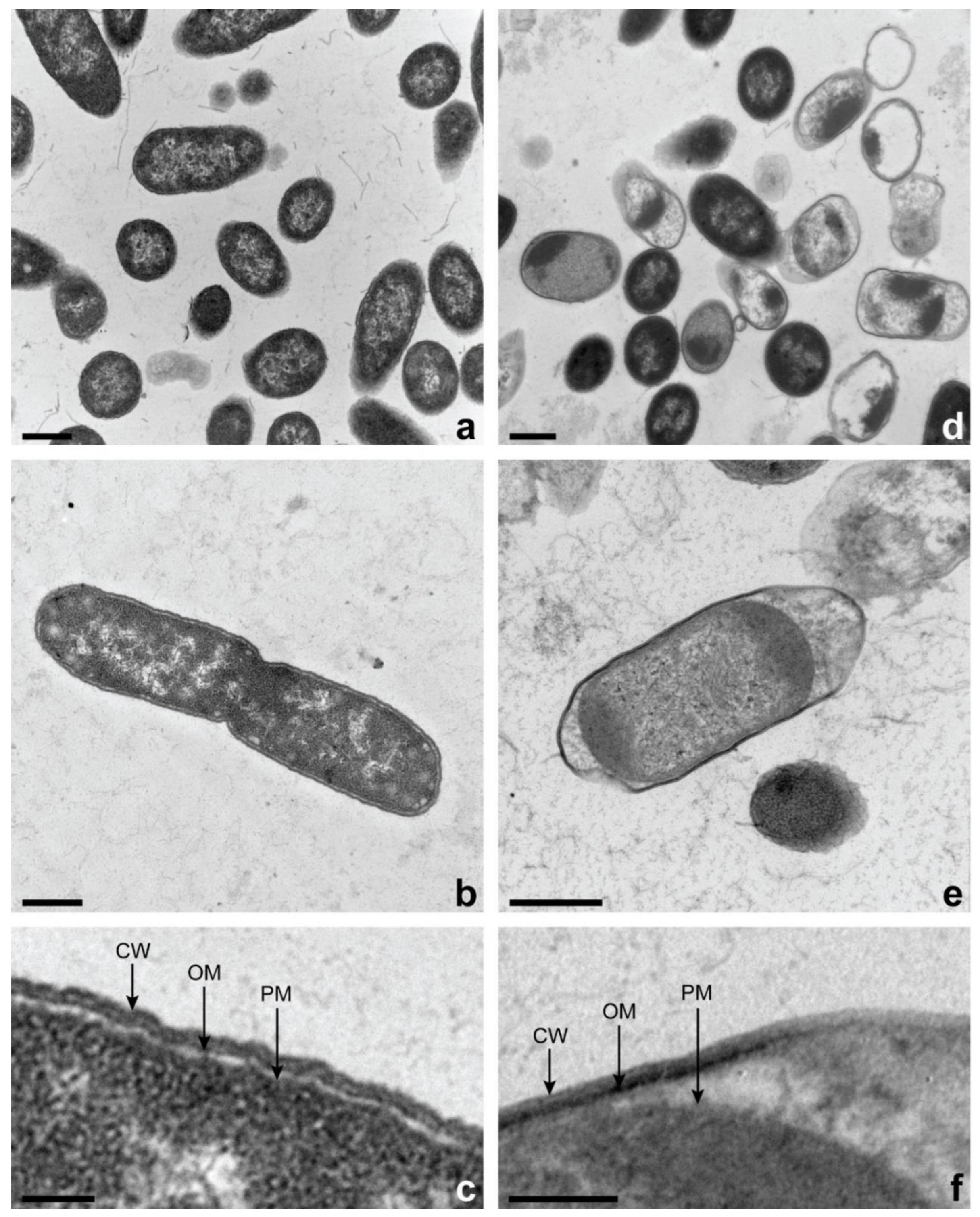 Microorganisms 11 02943 g005