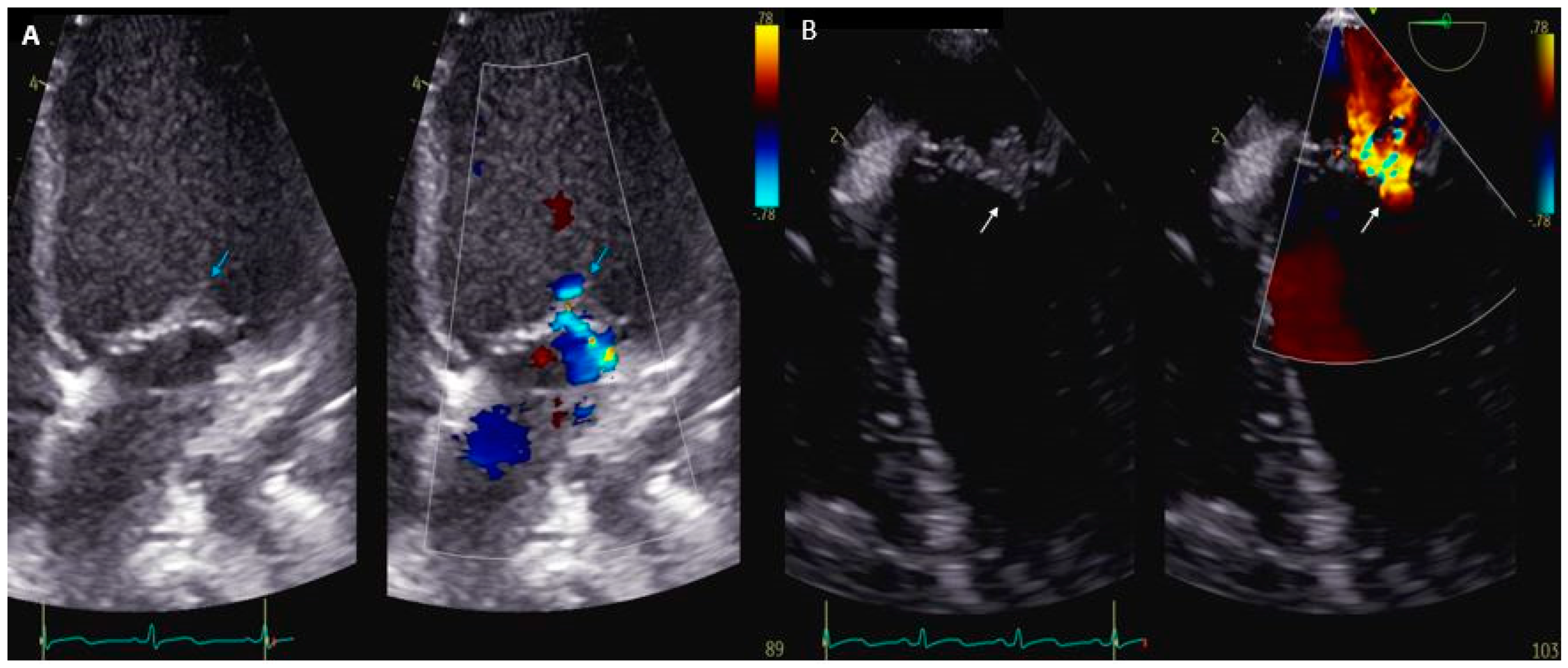 Microorganisms 12 00164 g001 Microorganisms 12 00164 g001