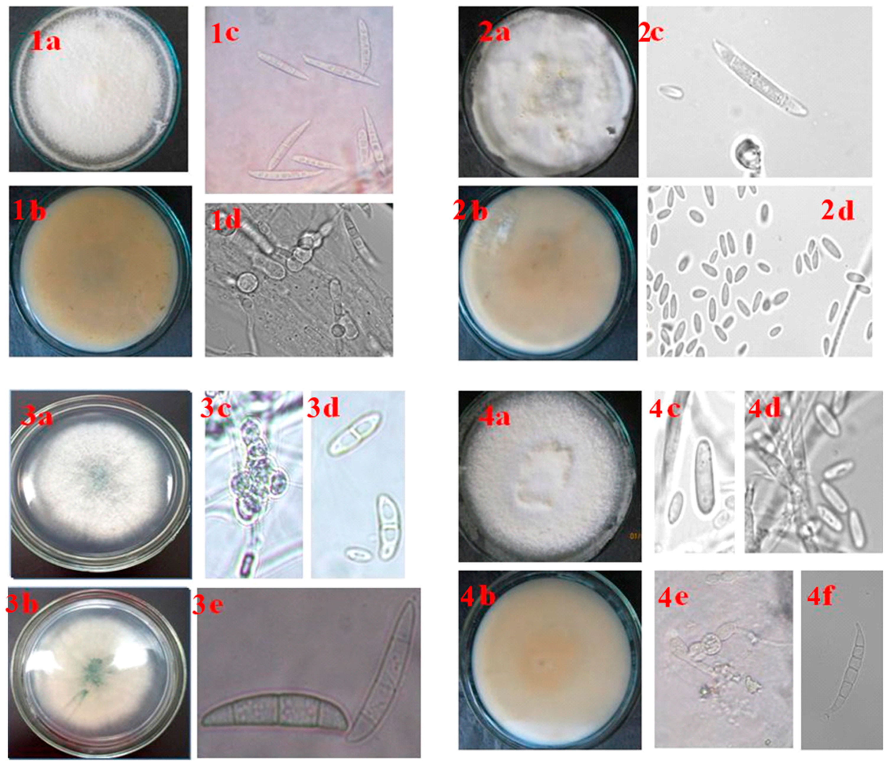 Microorganisms 12 00343 g008 Microorganisms 12 00343 g008