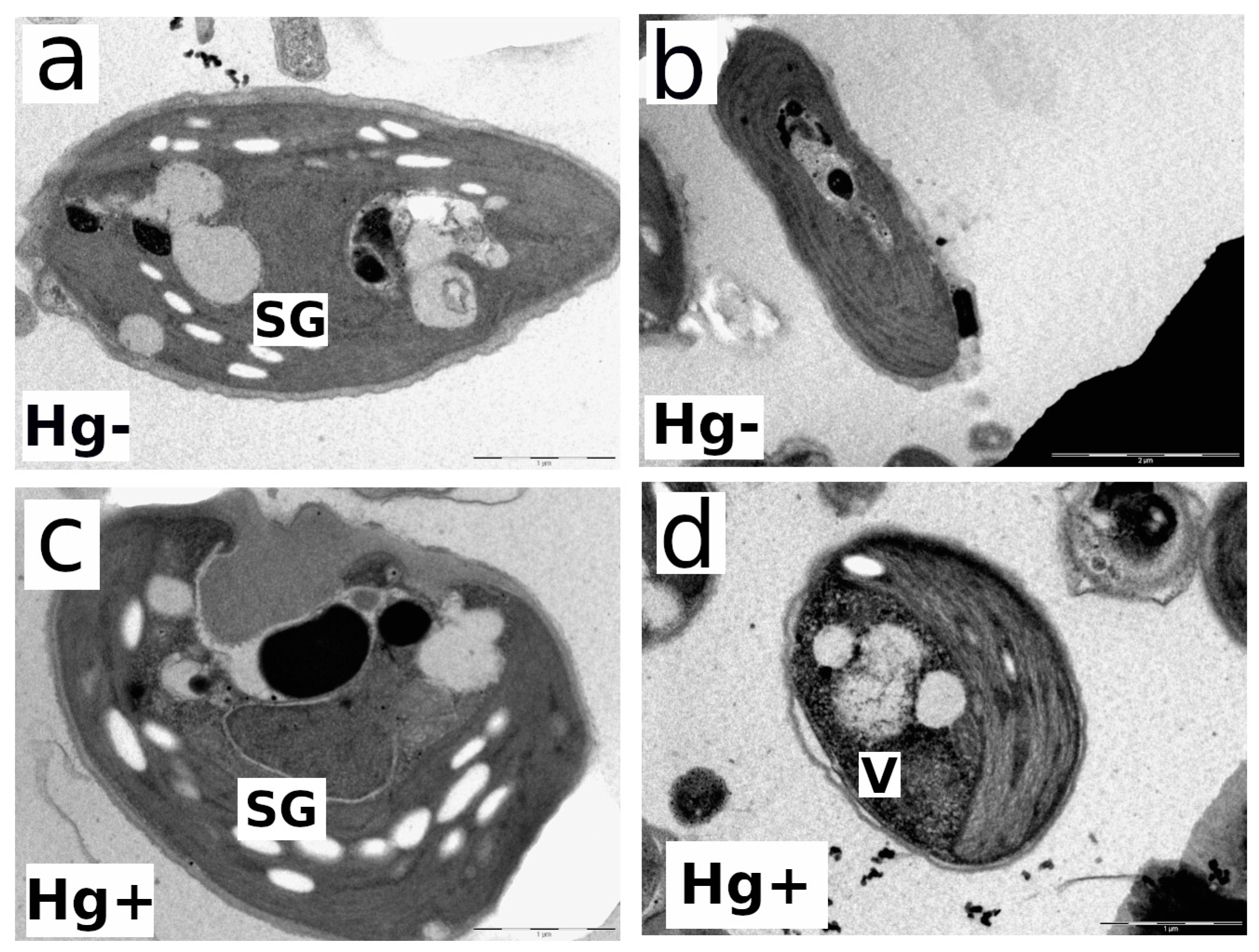 Microorganisms 12 00434 g005 Microorganisms 12 00434 g005