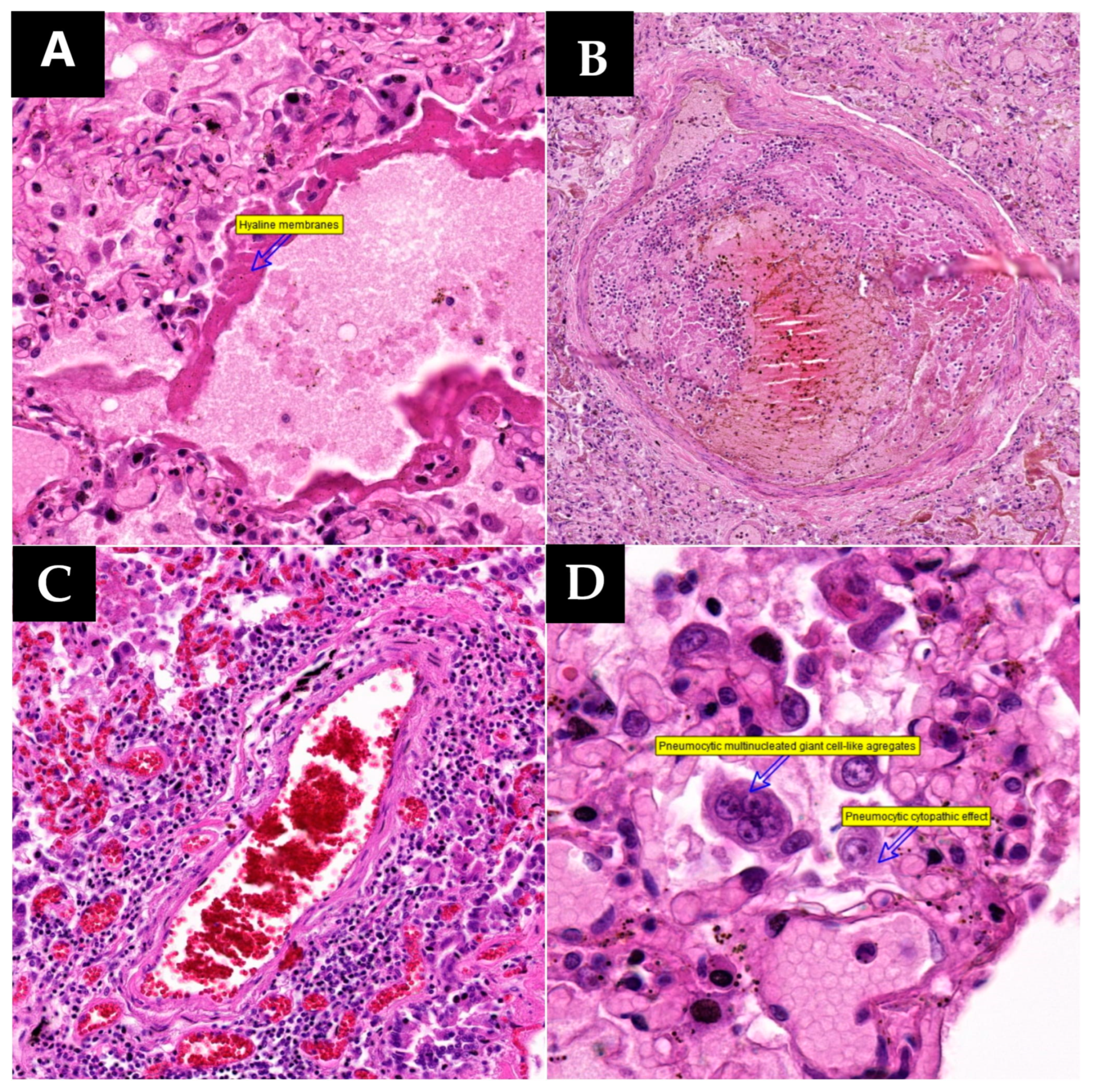 Microorganisms 12 00459 g002a