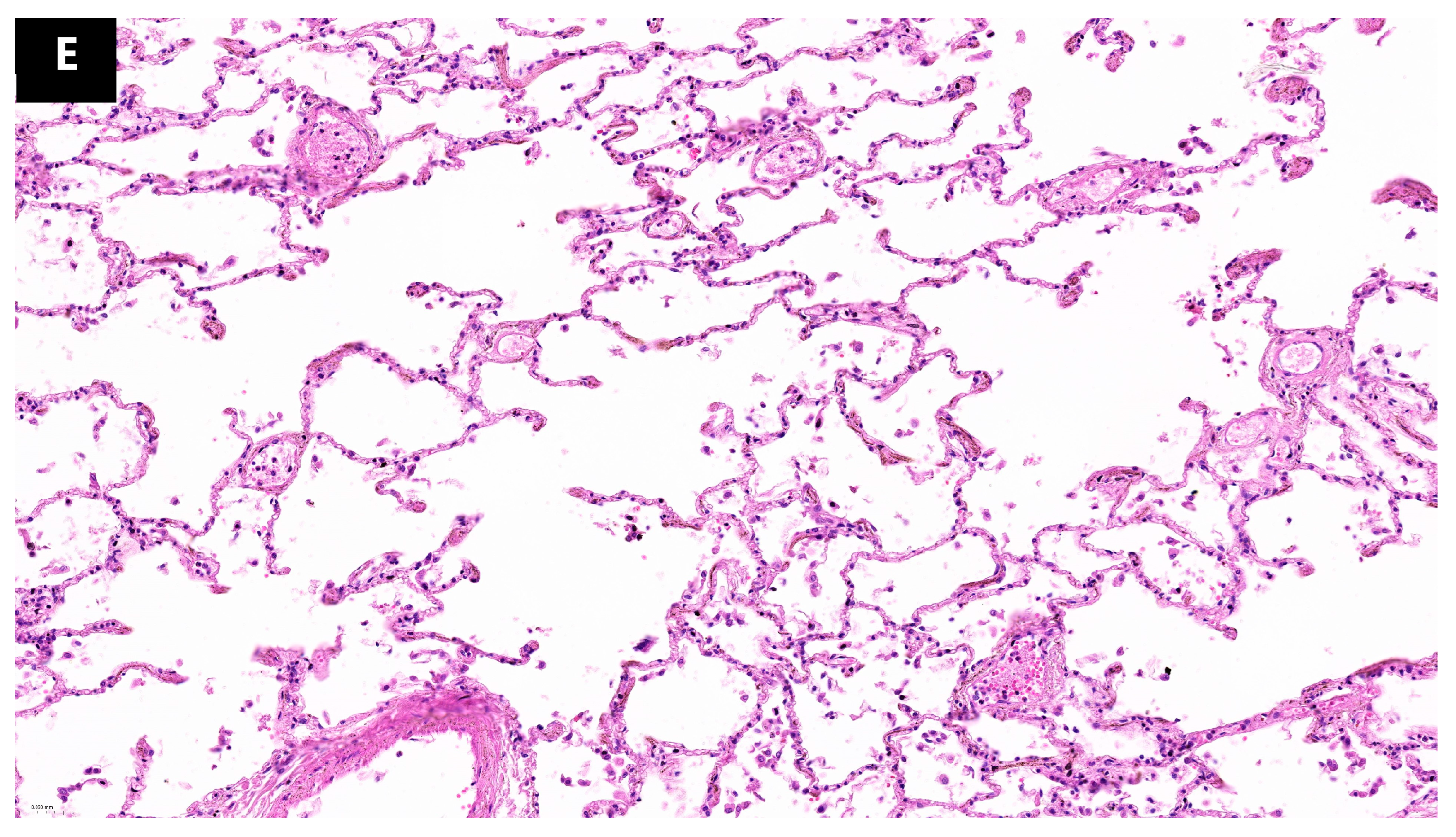 Microorganisms 12 00459 g003b