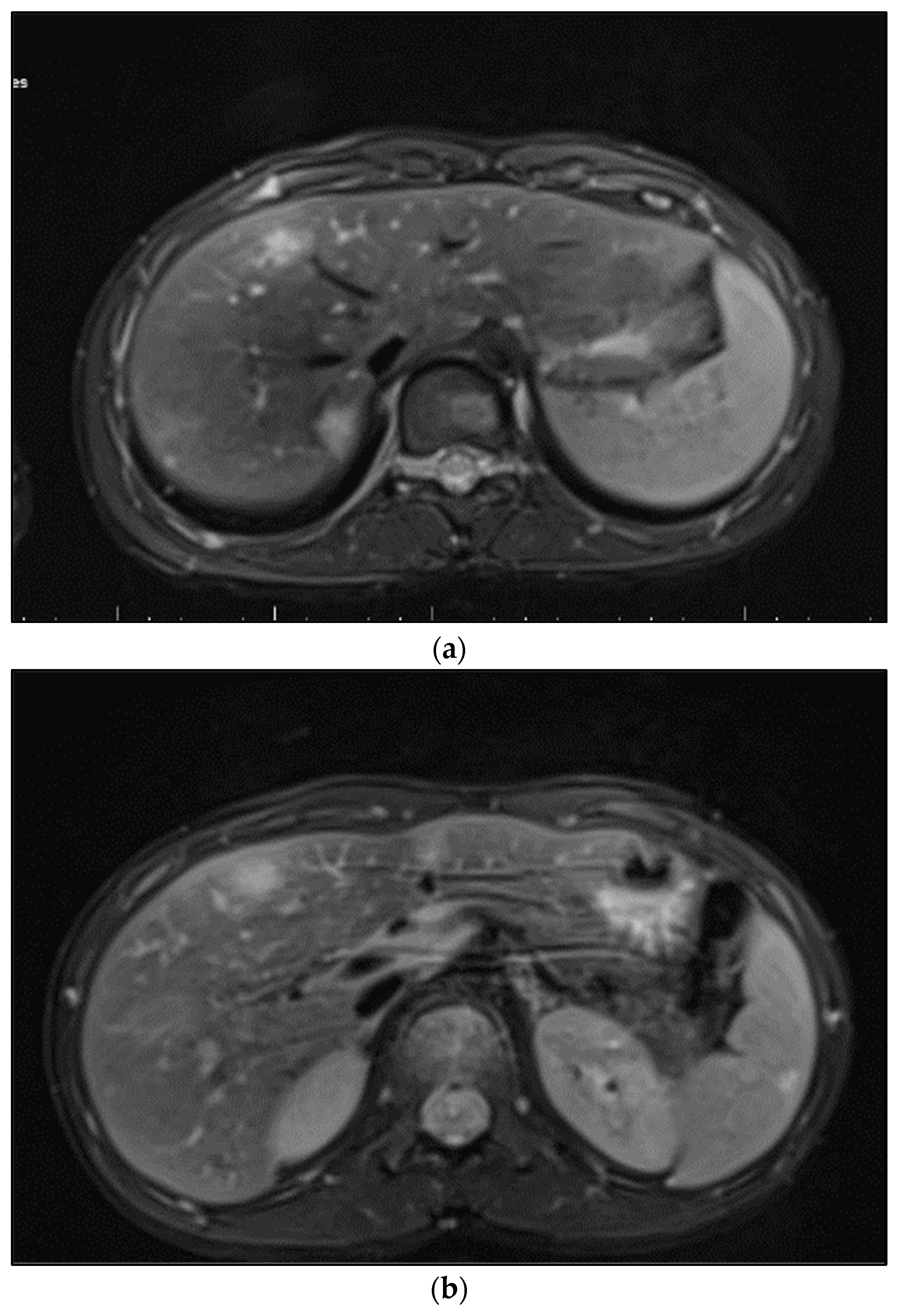 Microorganisms 12 00666 g002