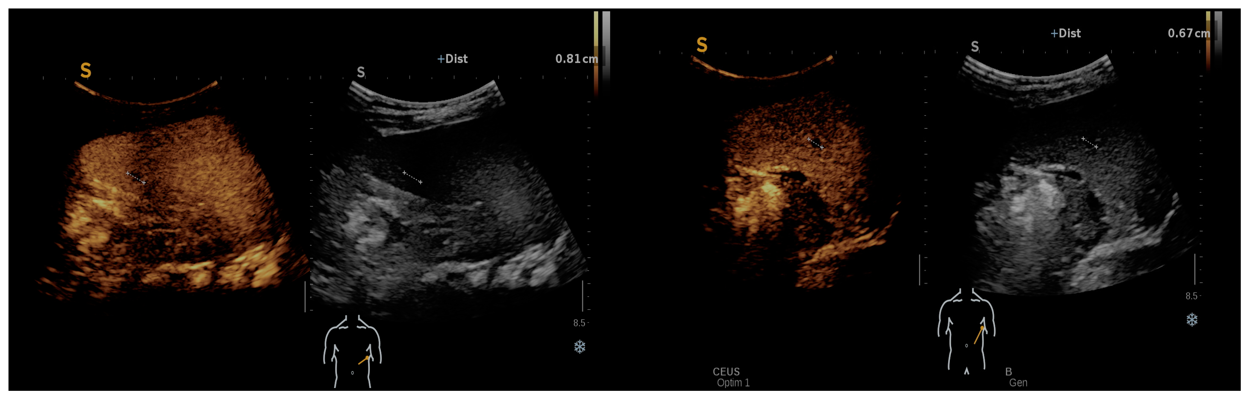 Microorganisms 12 00666 g003