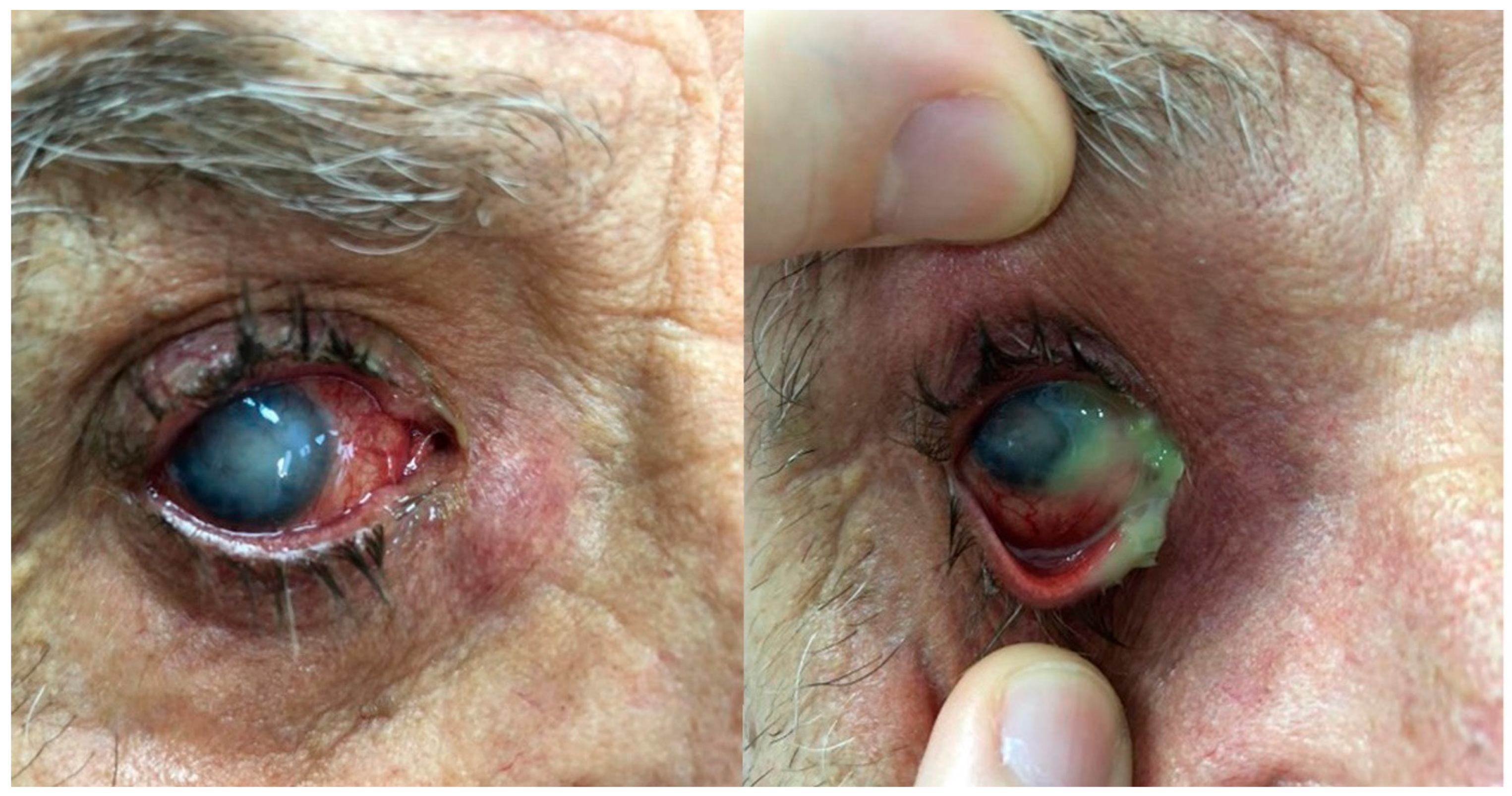 Microorganisms 12 00787 g001 Microorganisms 12 00787 g001