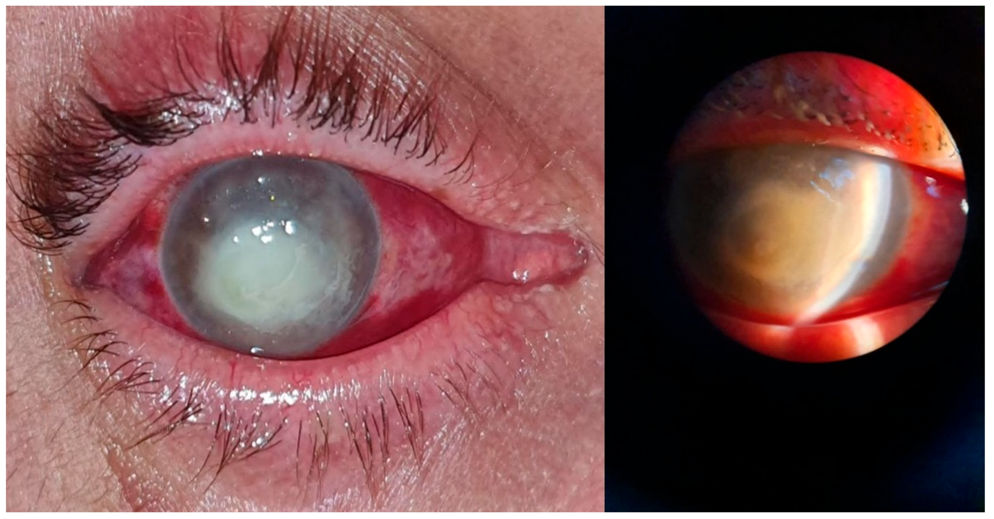 Microorganisms 12 00787 g003 Microorganisms 12 00787 g003