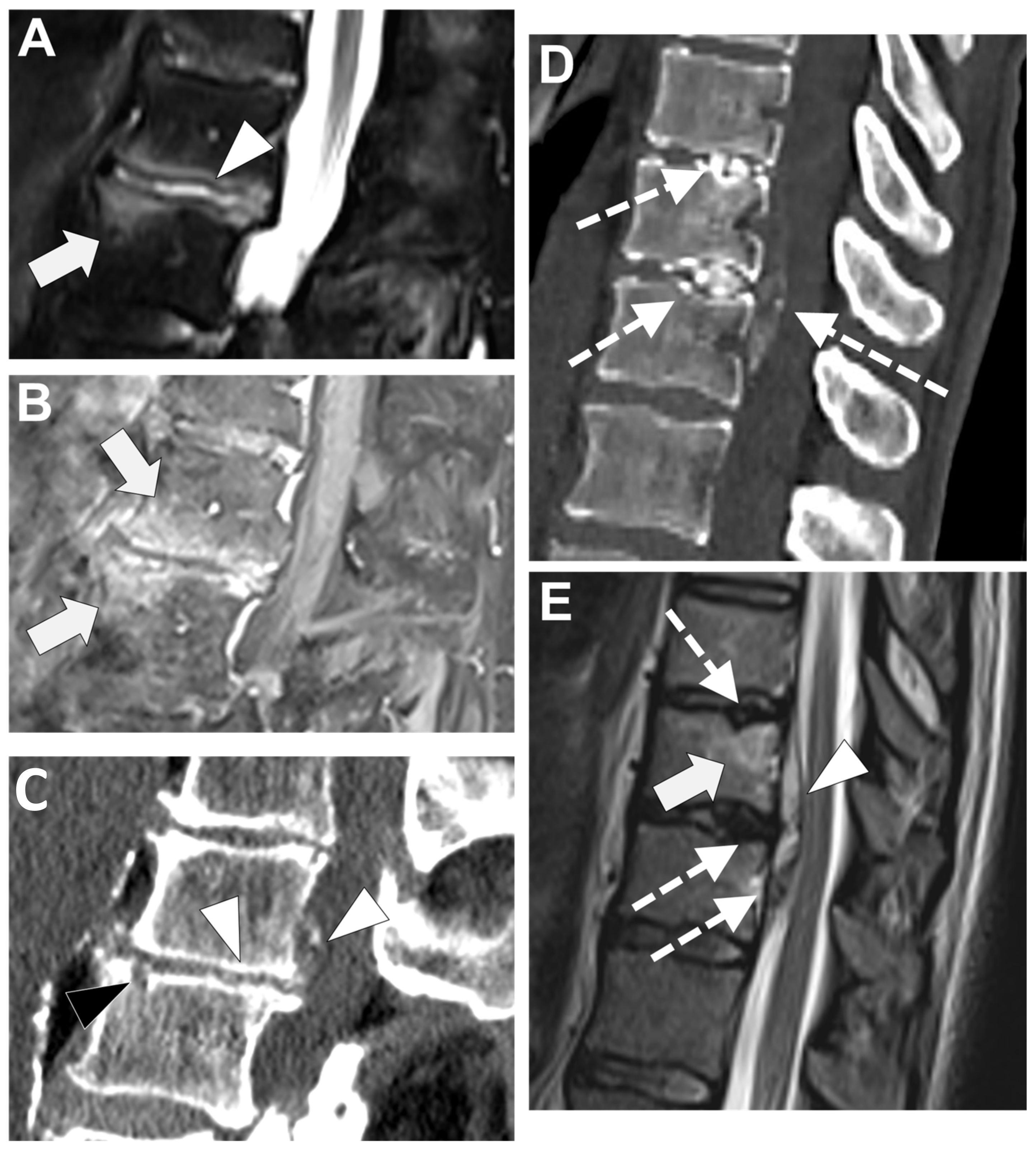 Microorganisms 12 00893 g011