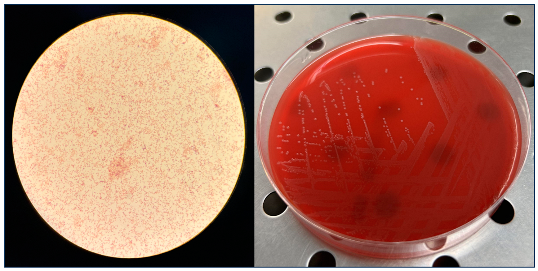 Microorganisms 12 00942 g001