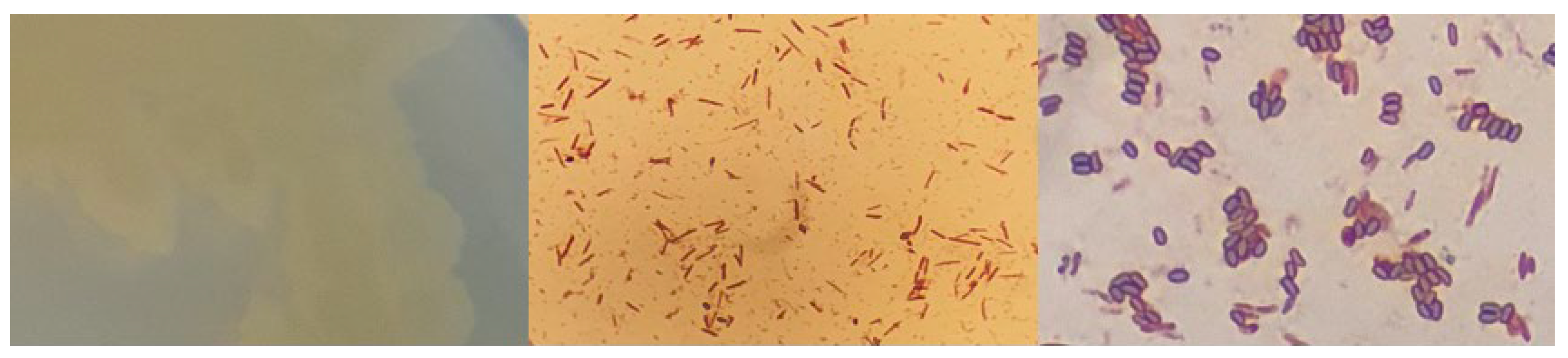 Microorganisms 12 01066 g0a11