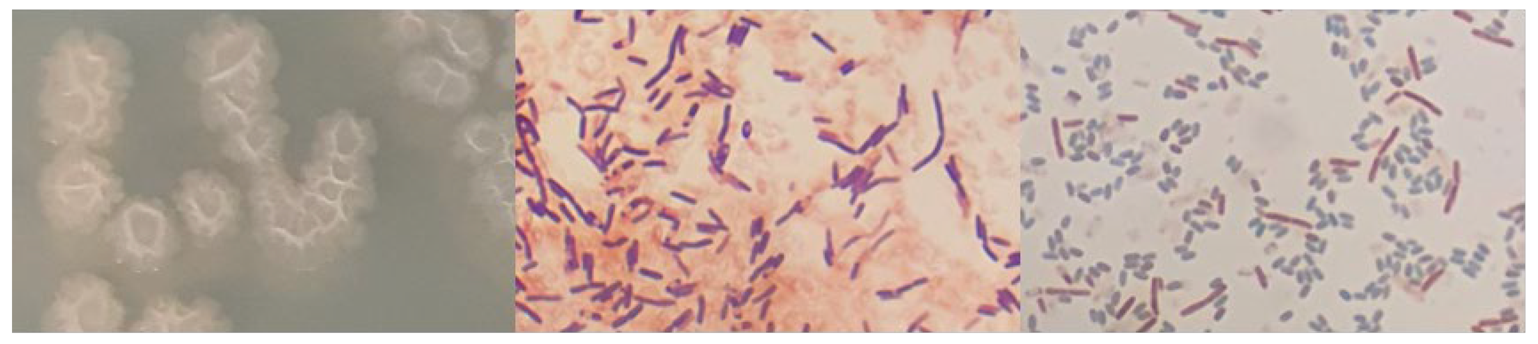 Microorganisms 12 01066 g0a12