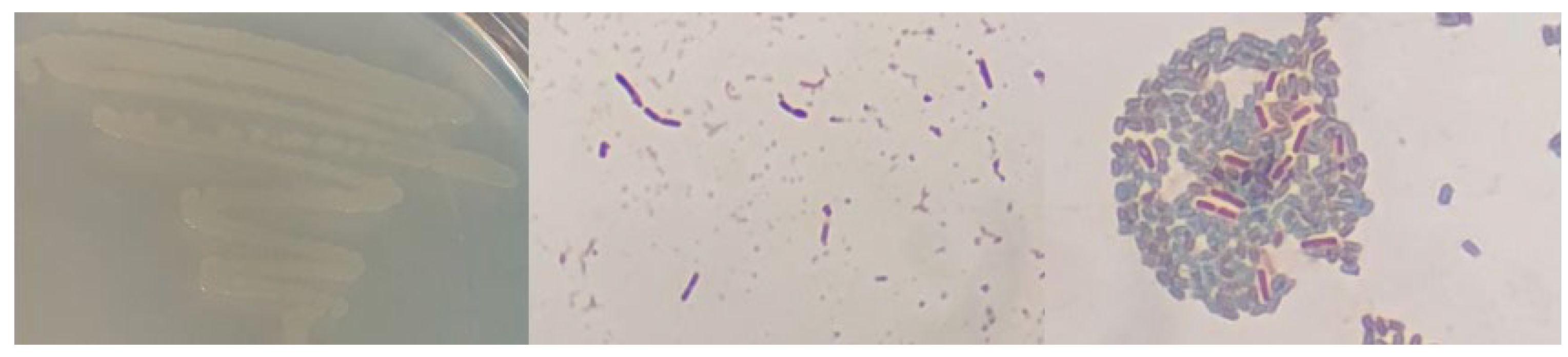 Microorganisms 12 01066 g0a16