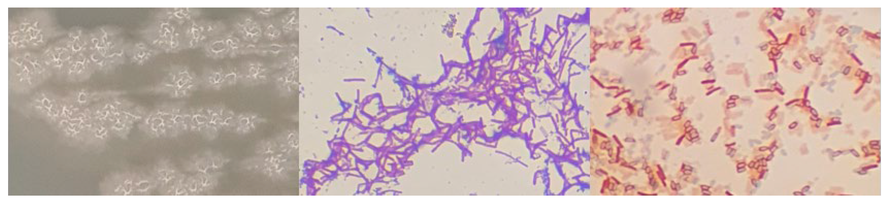 Microorganisms 12 01066 g0a2