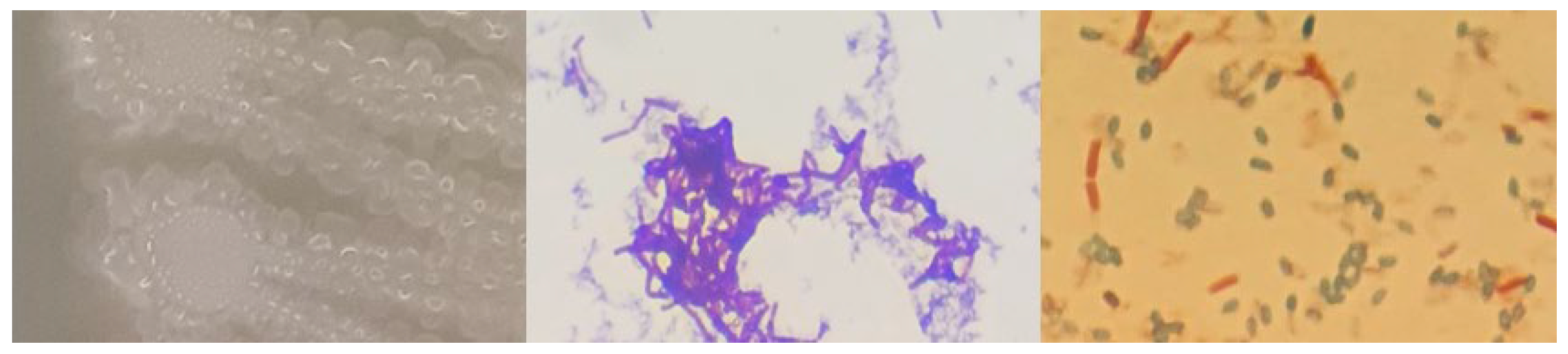 Microorganisms 12 01066 g0a3