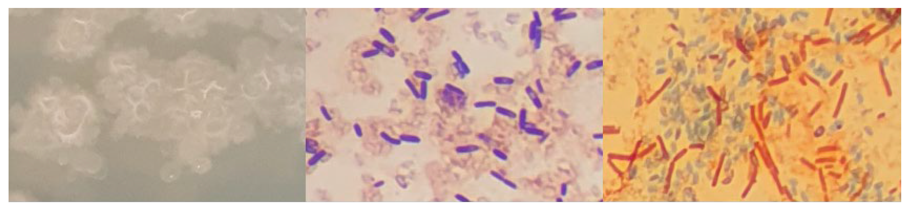 Microorganisms 12 01066 g0a6