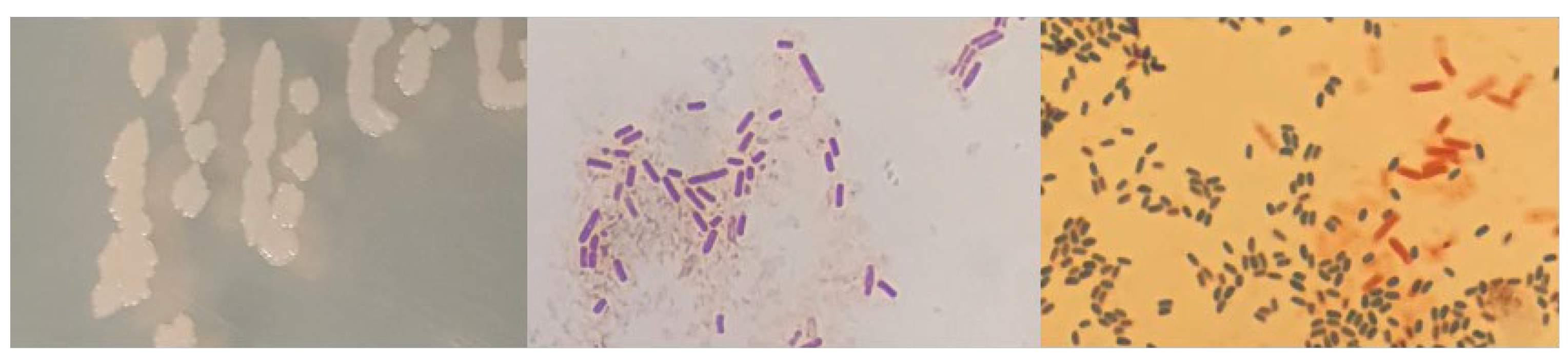 Microorganisms 12 01066 g0a8