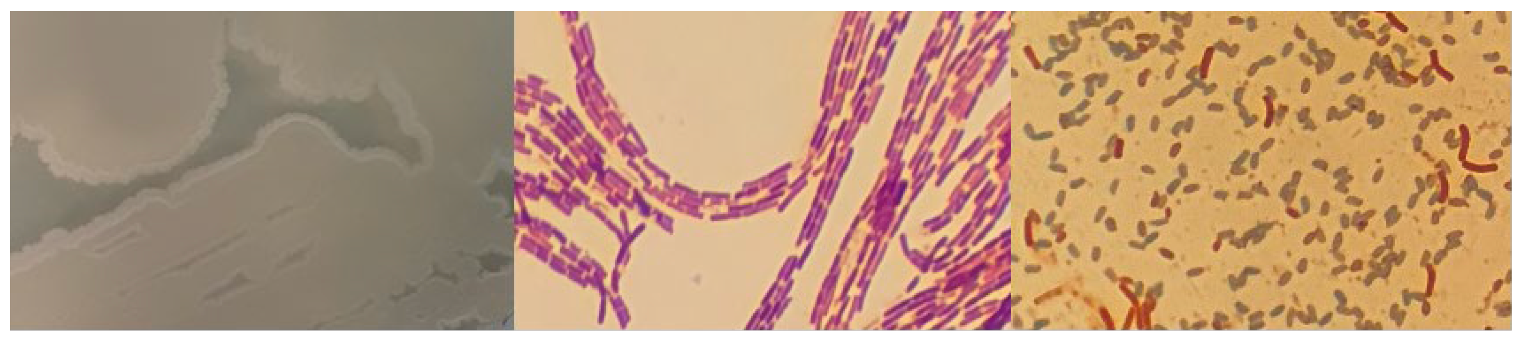Microorganisms 12 01066 g0a9