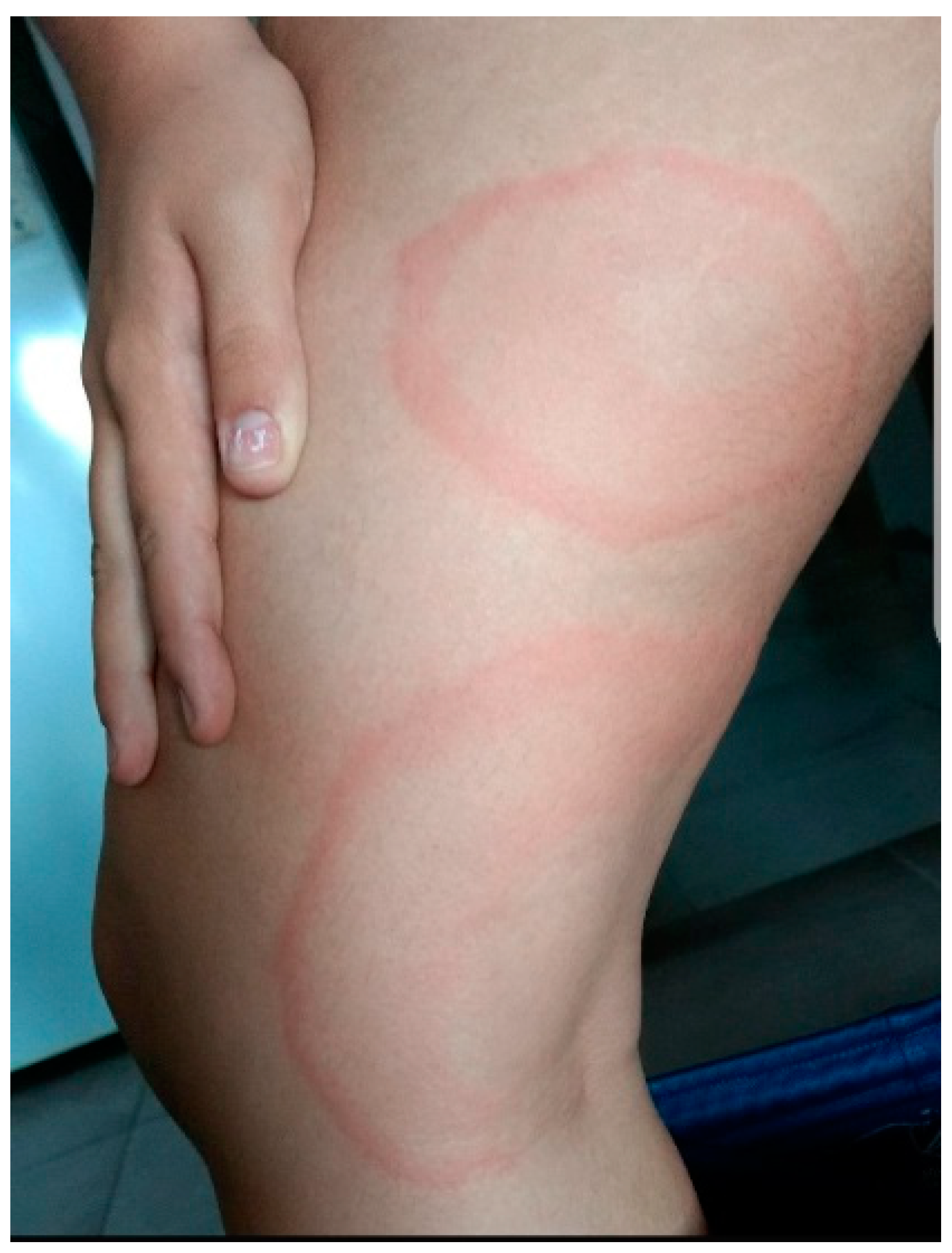 Microorganisms 12 01374 g001