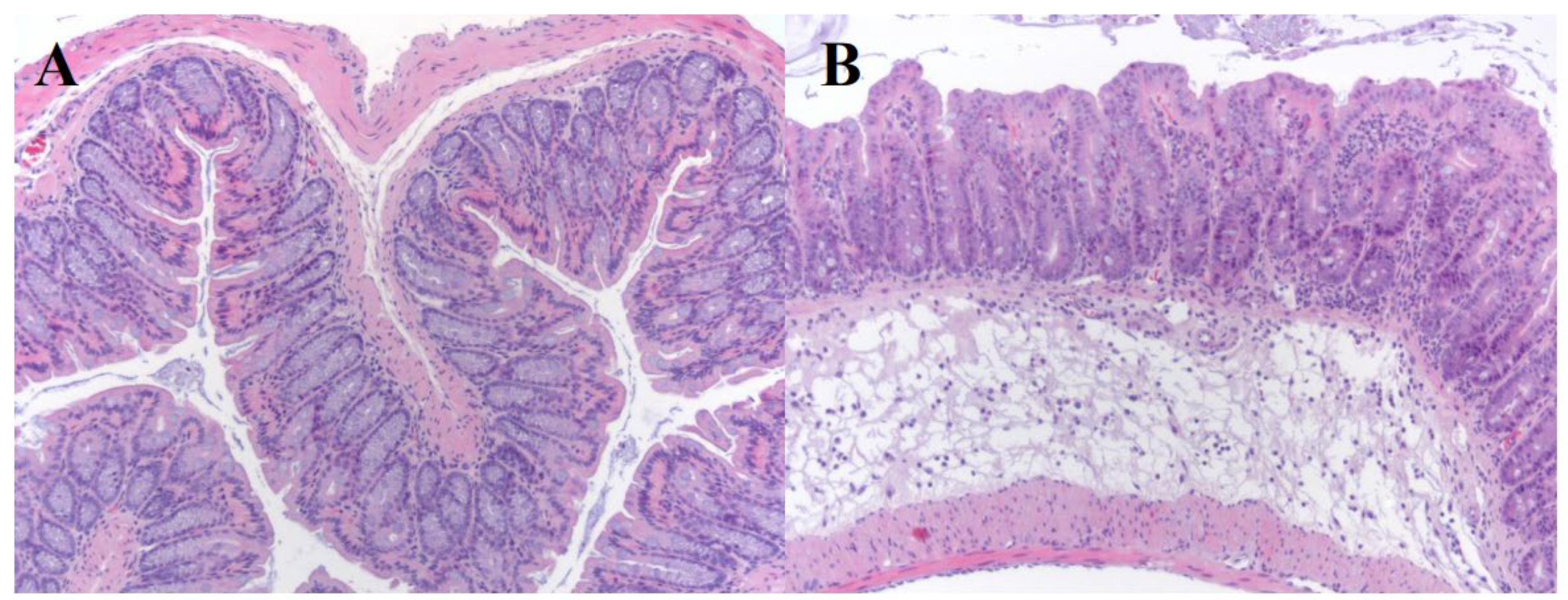 Protective Effects of Huo Xiang Zheng Qi Liquid on