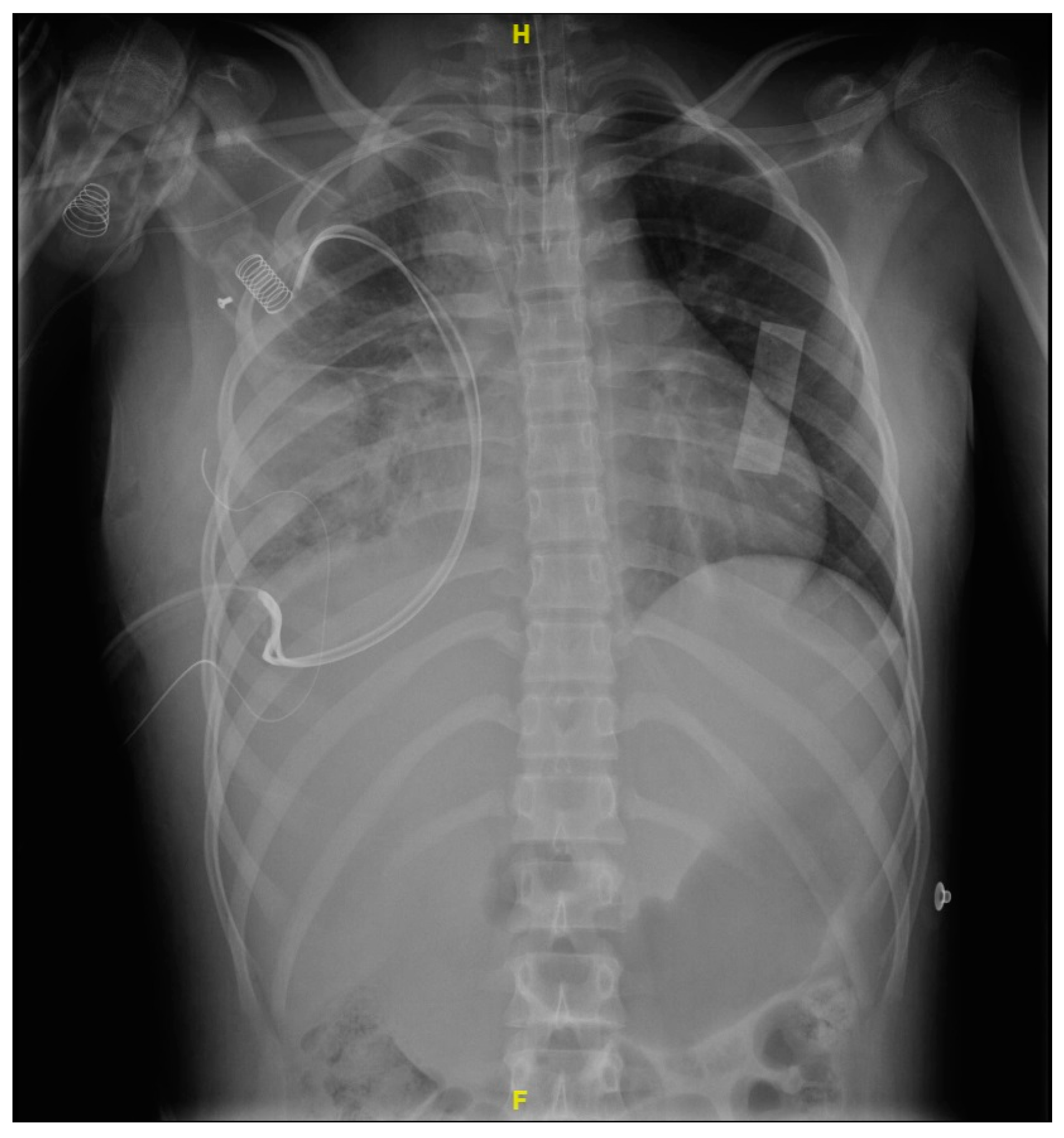 Microorganisms 12 01881 g004