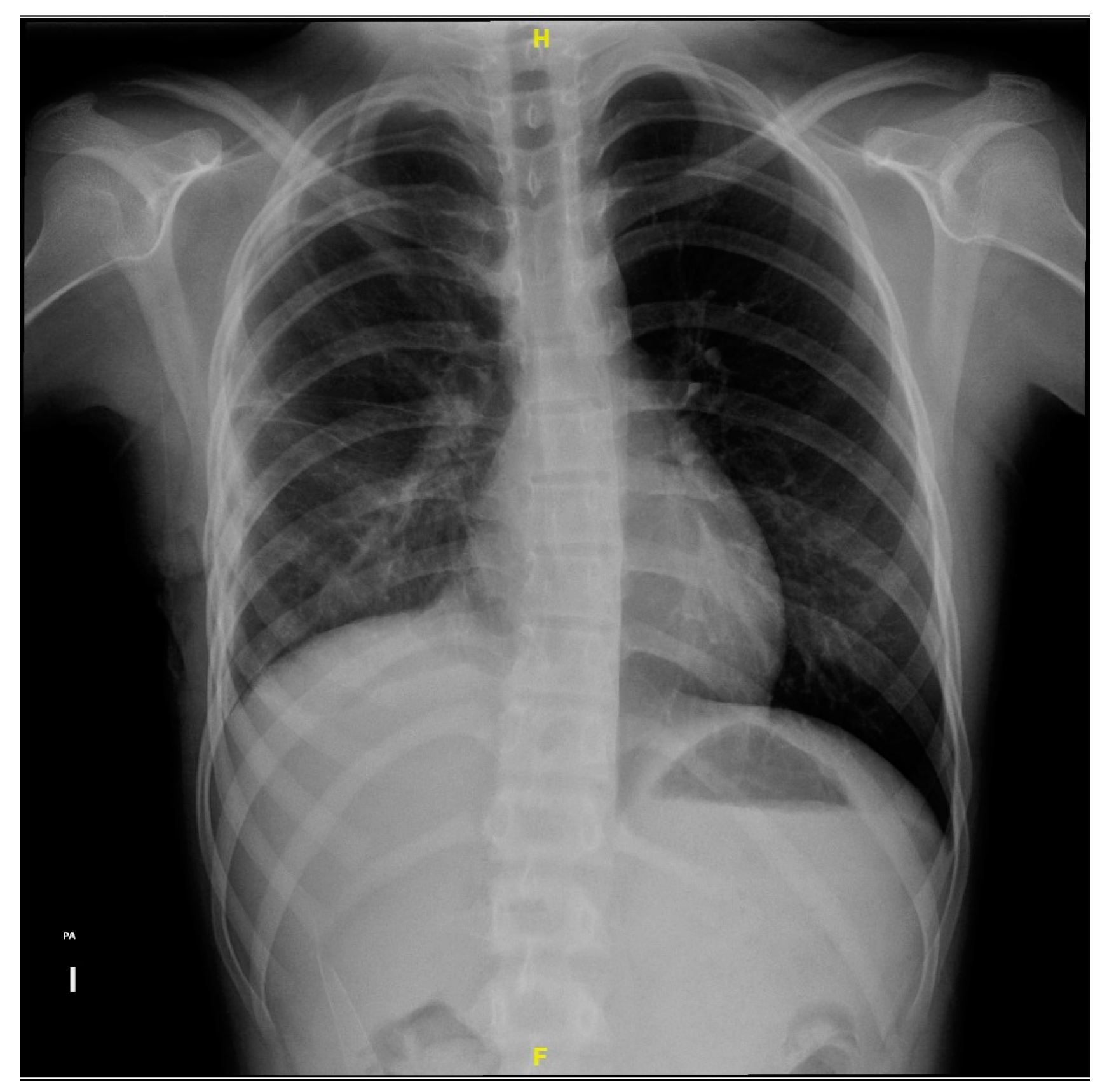 Microorganisms 12 01881 g006