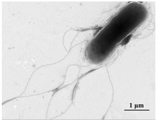 Pathogenicity of Citrobacter freundii Causing Mass