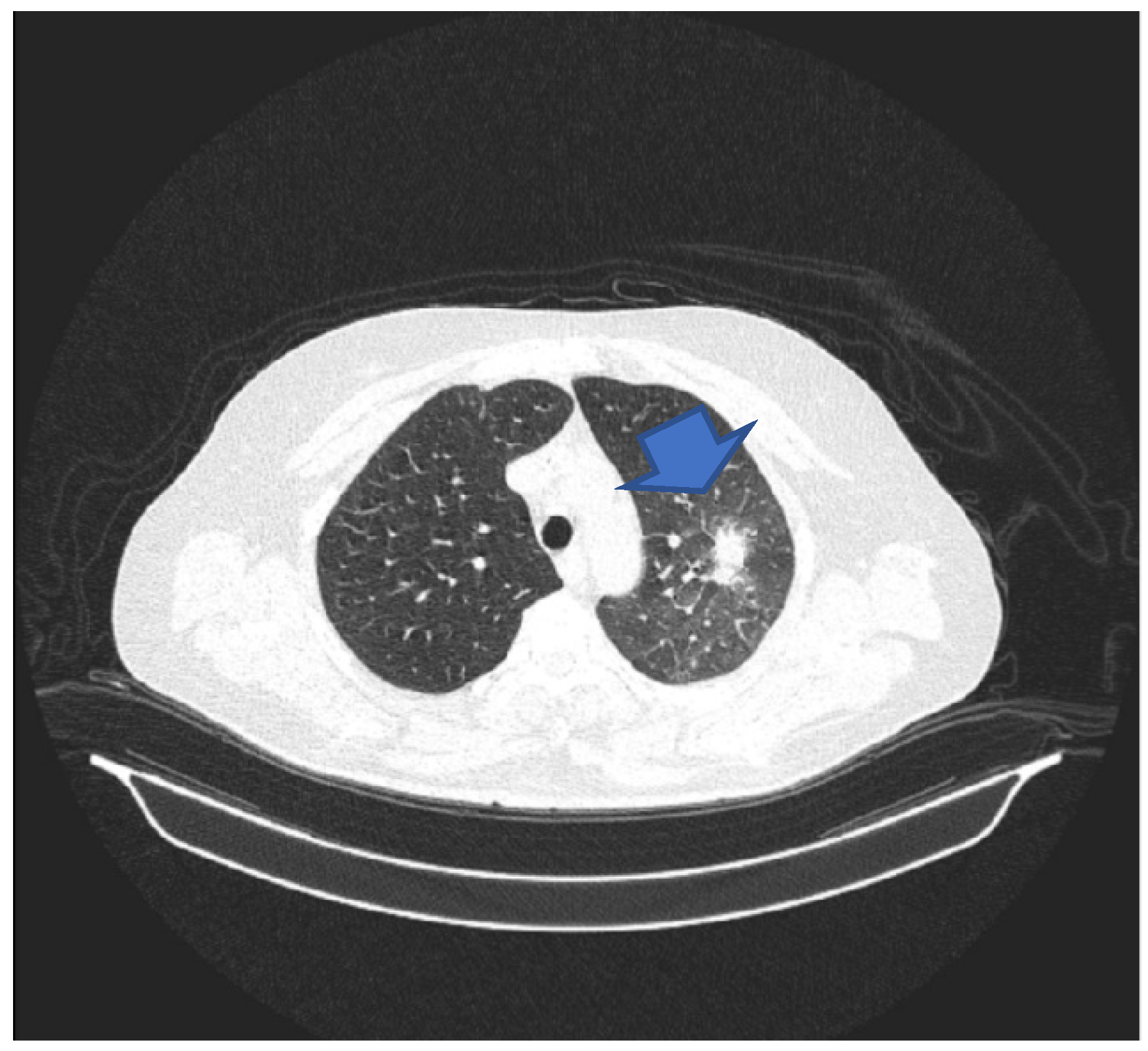 Microorganisms 12 02215 g001