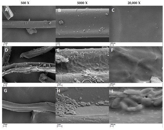 Treatment of Cigarette Butts: Biodegradation of Cellulose Acetate by ...