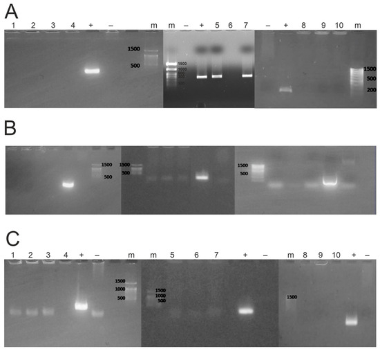 Investigation of Antibiotic Resistance of E. coli Associated