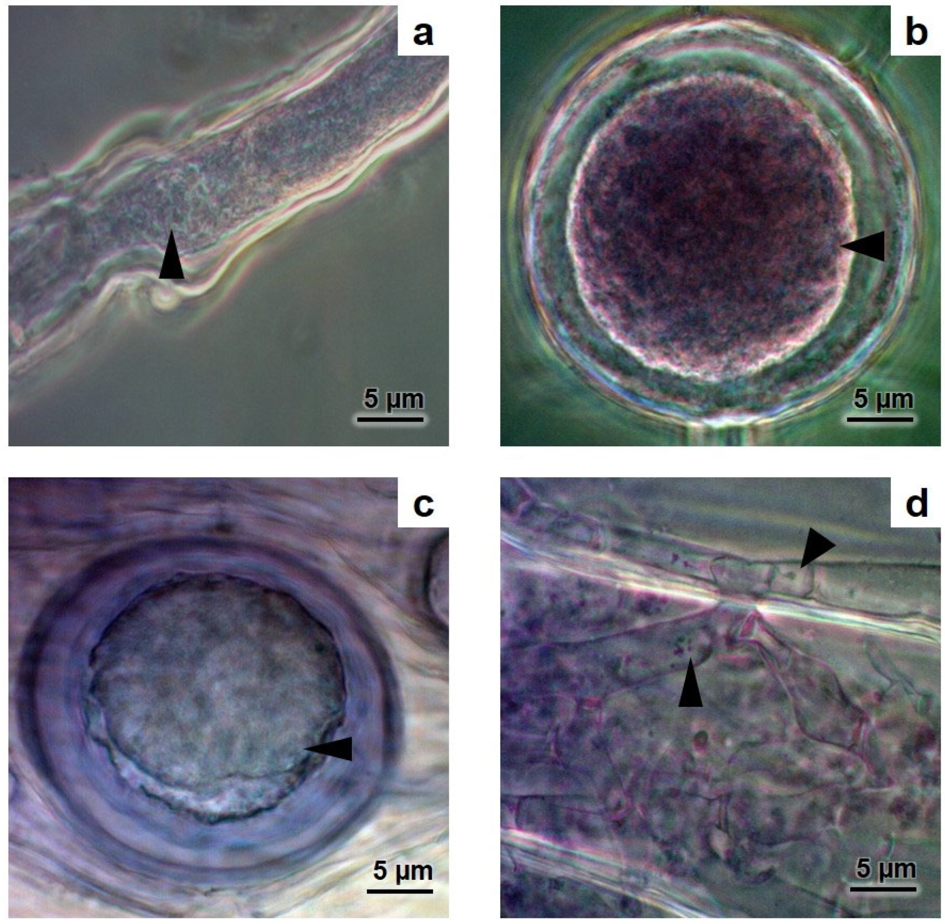 スワン ミネラルの2本セット Arbuscular Mycorrhizal Fungi as a Salt Bioaccumulation Mechanism