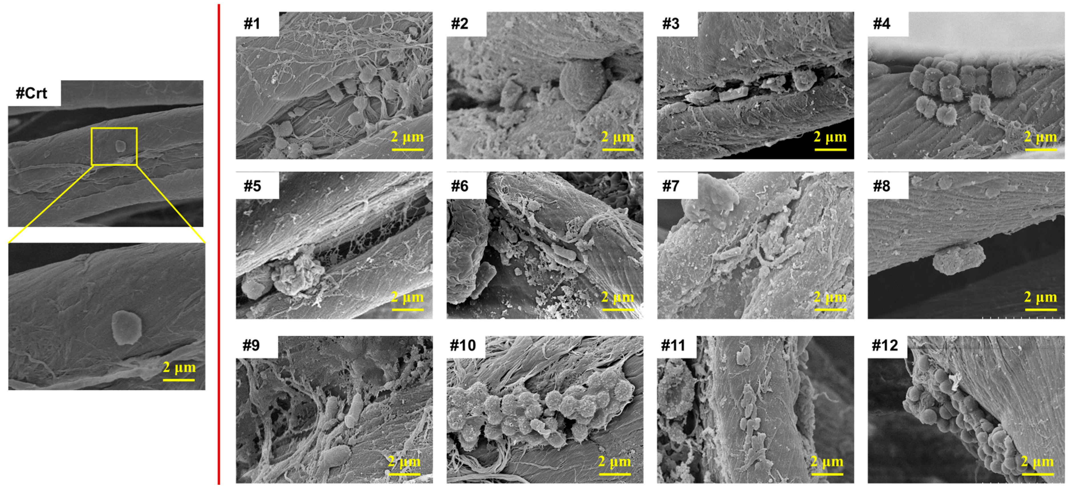 Microorganisms 13 00097 g004