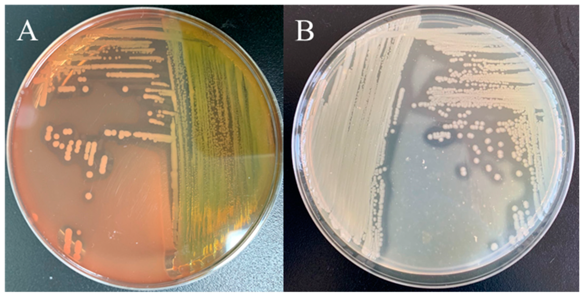 Microorganisms 13 00278 g004