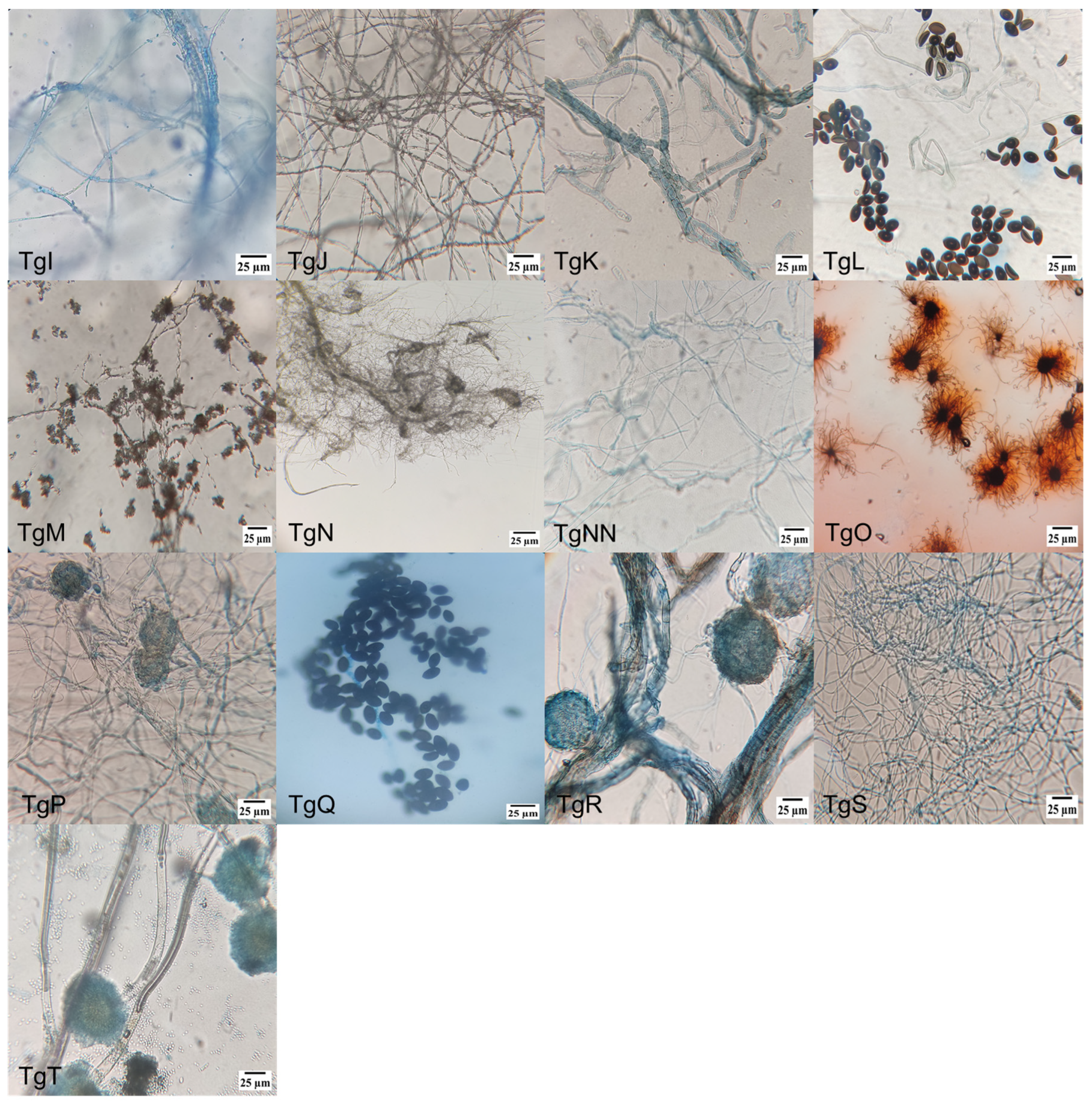 Microorganisms 13 00300 g001b