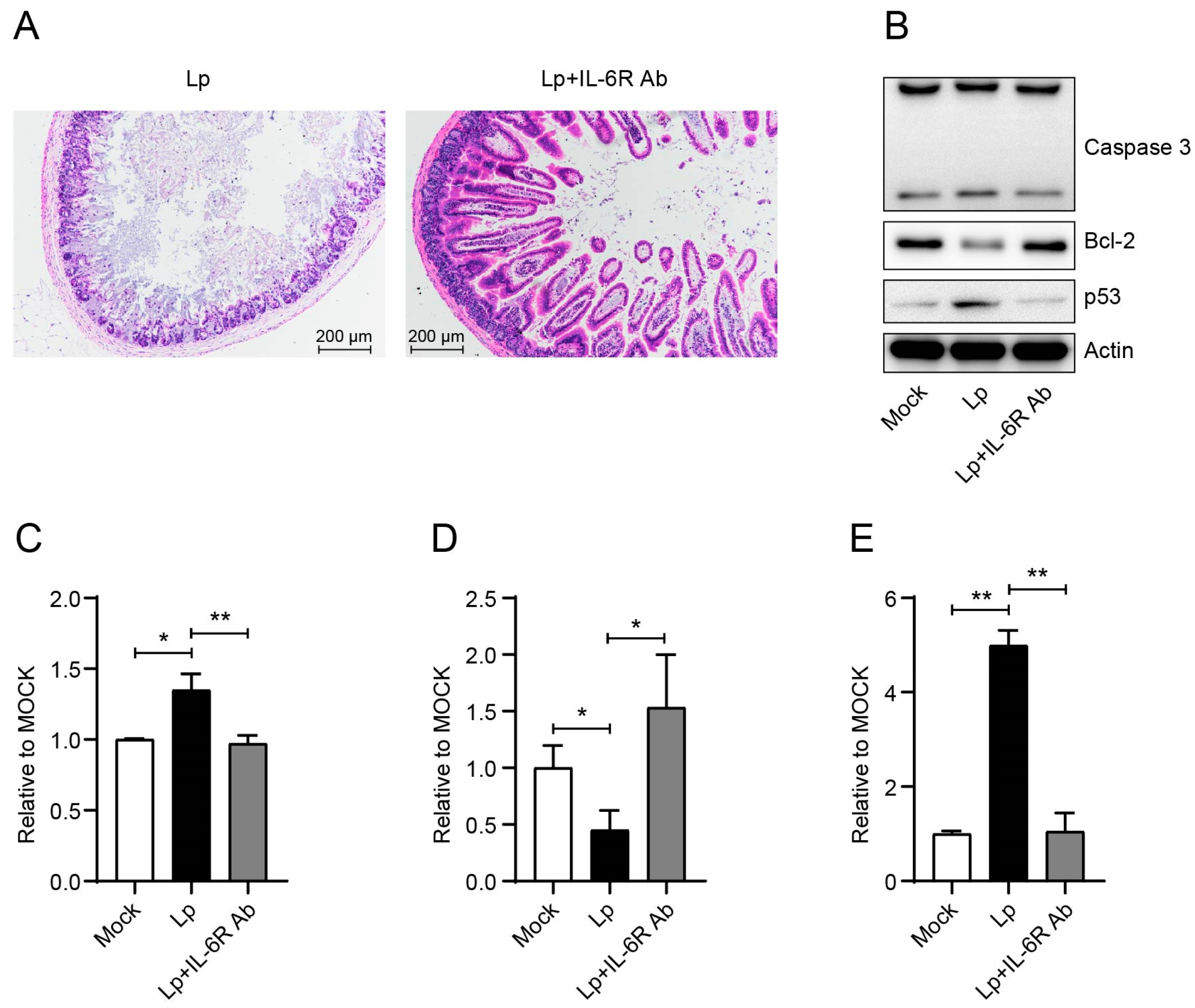 Microorganisms 13 00313 g006