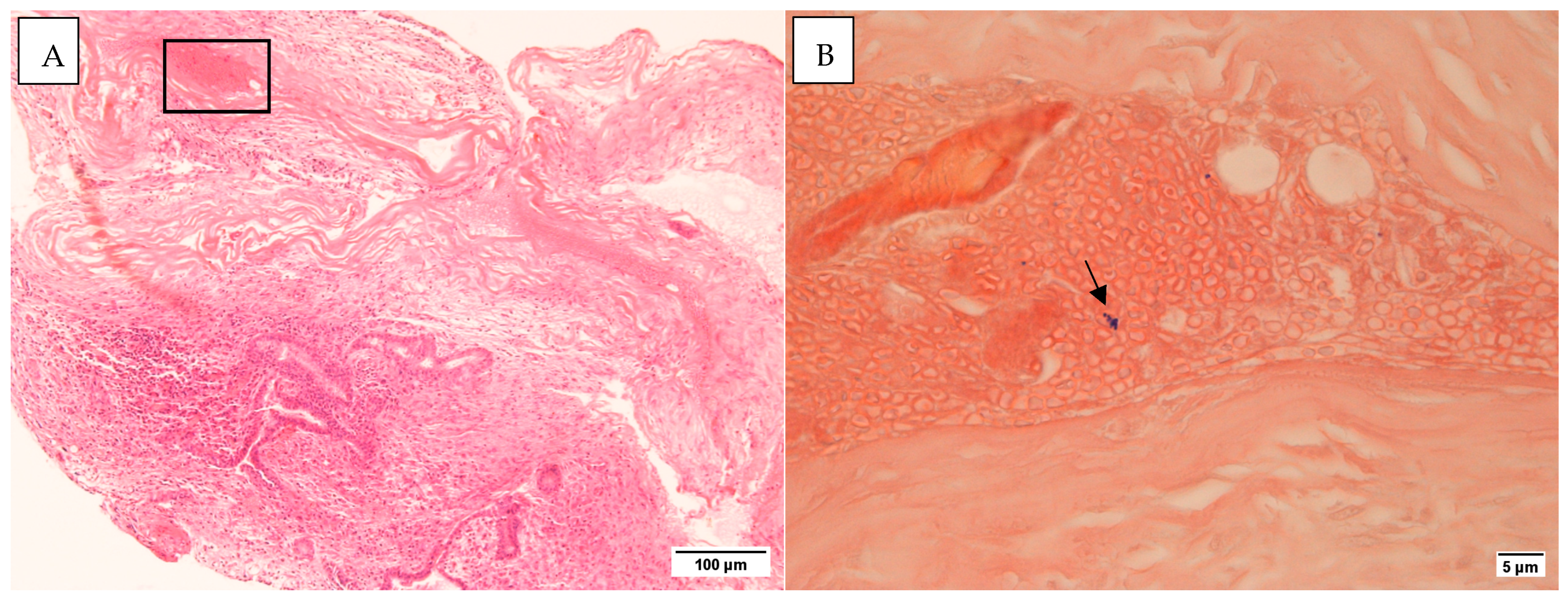 Microorganisms 13 00339 g002