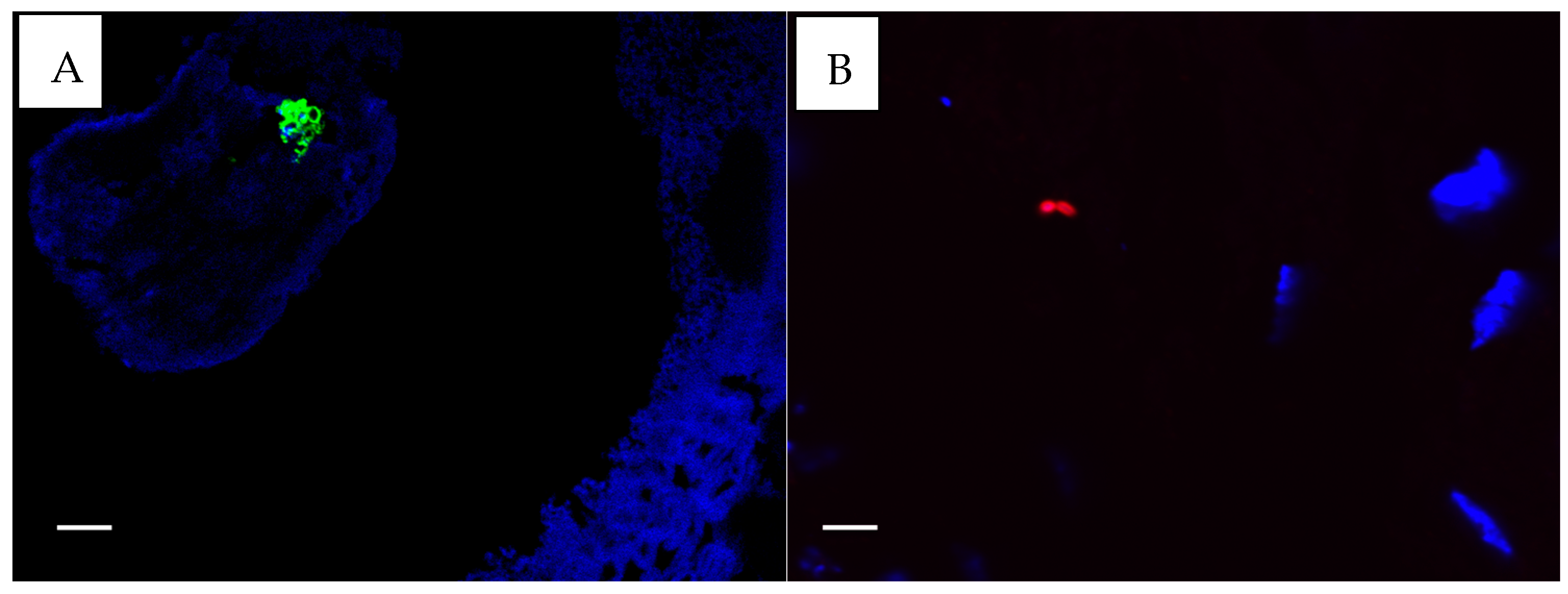 Microorganisms 13 00339 g003