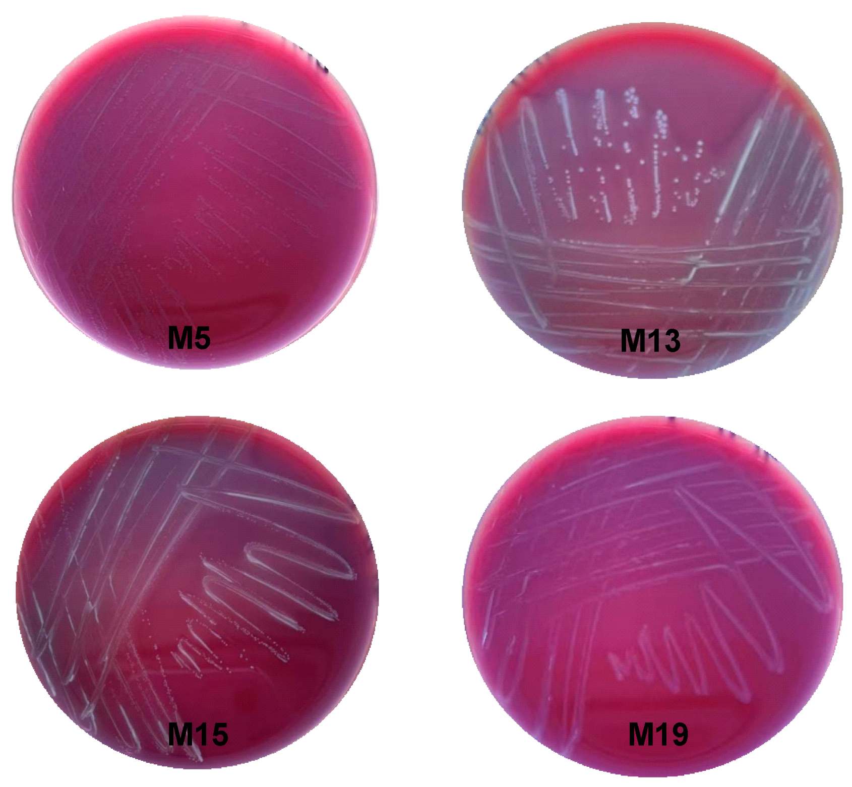Microorganisms 13 00404 g004