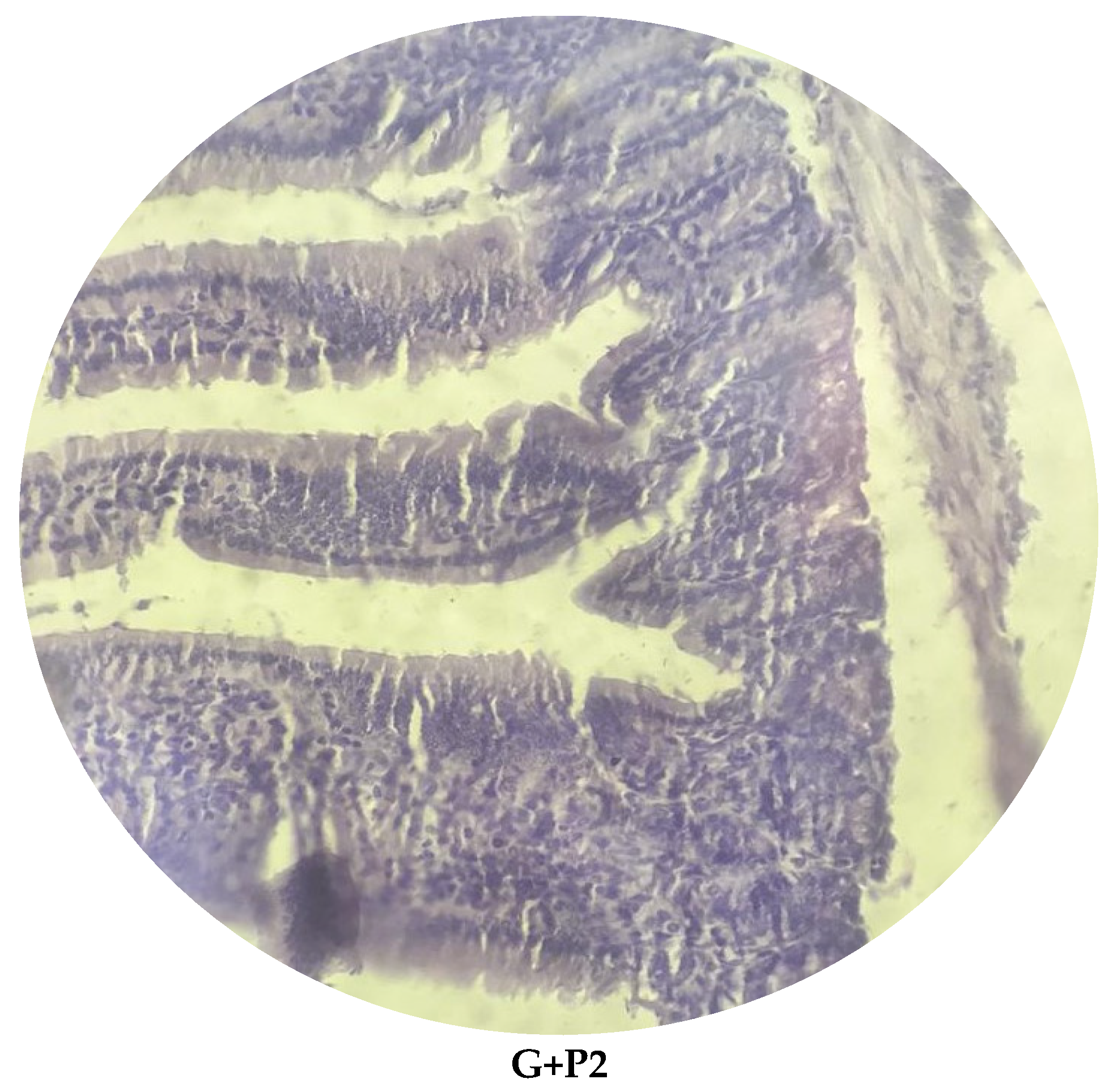 Microorganisms 13 00460 g006b